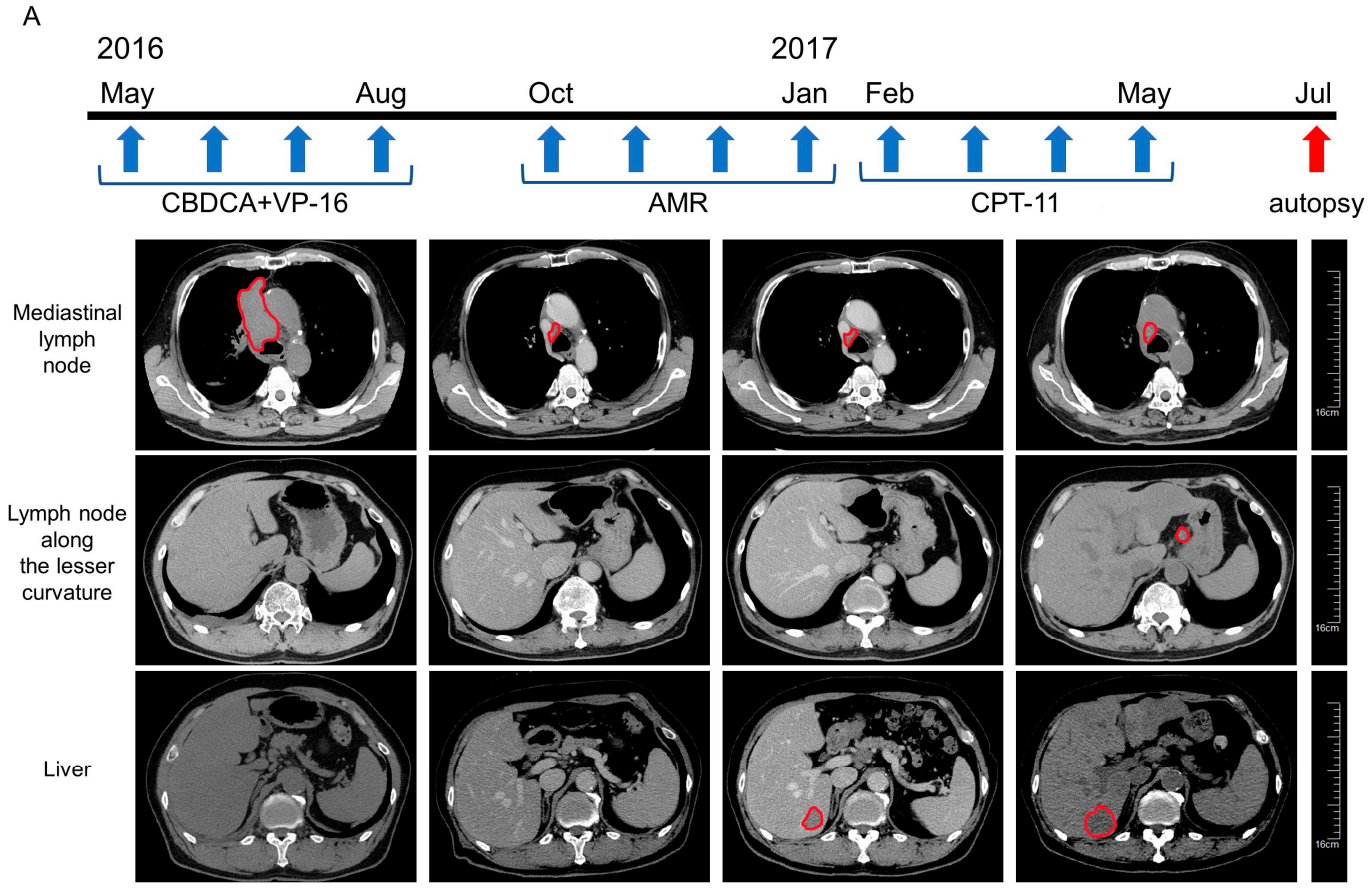 Cancers 13 01187 g001a Cancers 13 01187 g001a