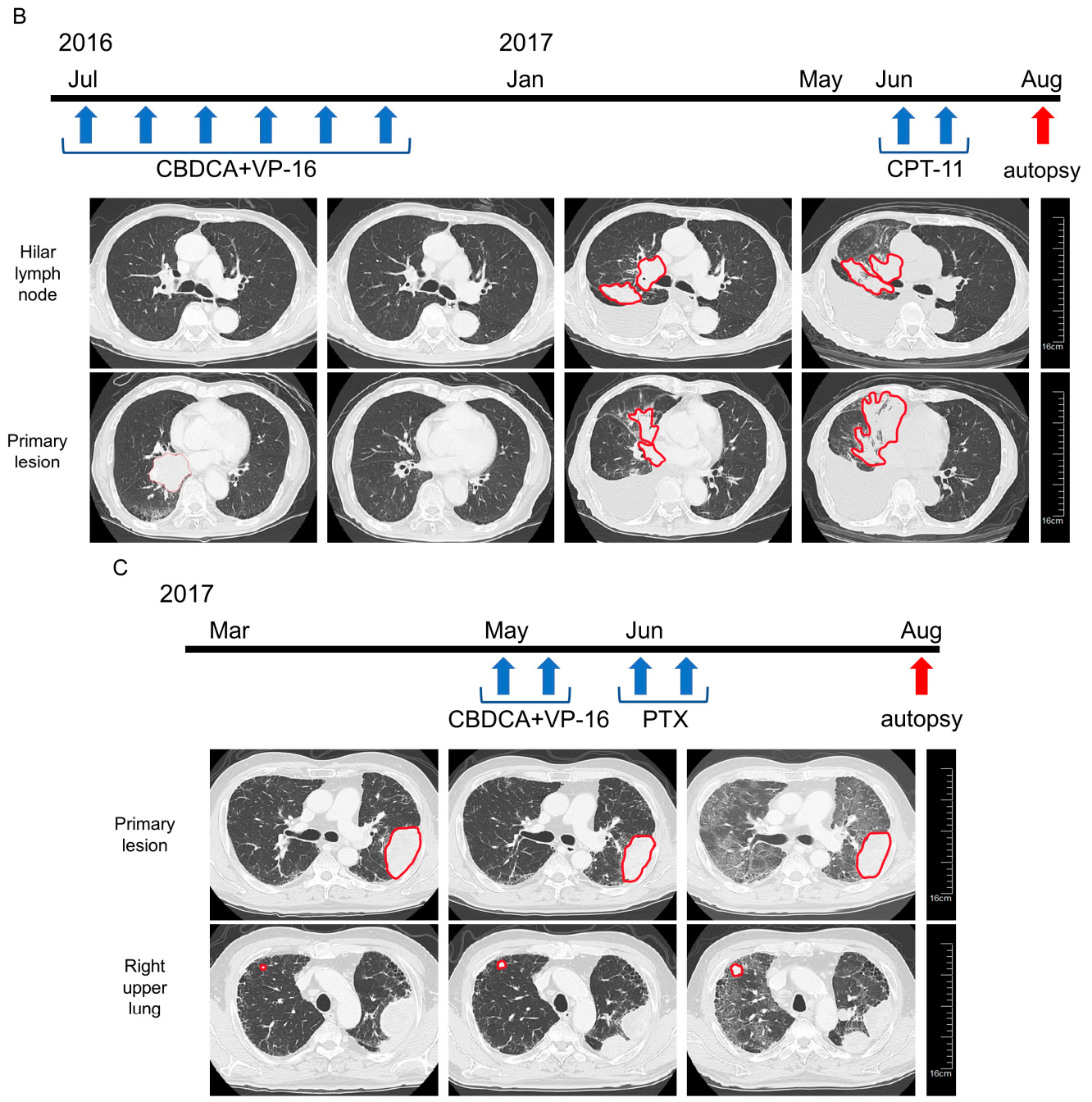 Cancers 13 01187 g001b Cancers 13 01187 g001b