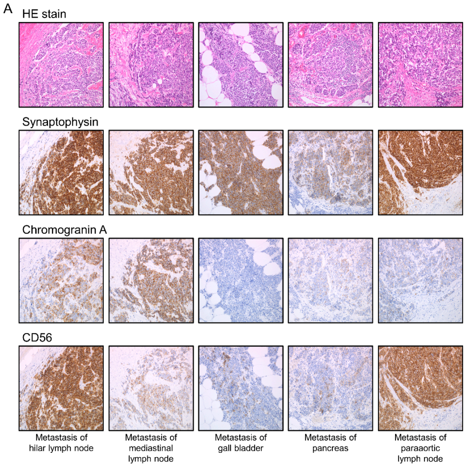 Cancers 13 01187 g002a Cancers 13 01187 g002a