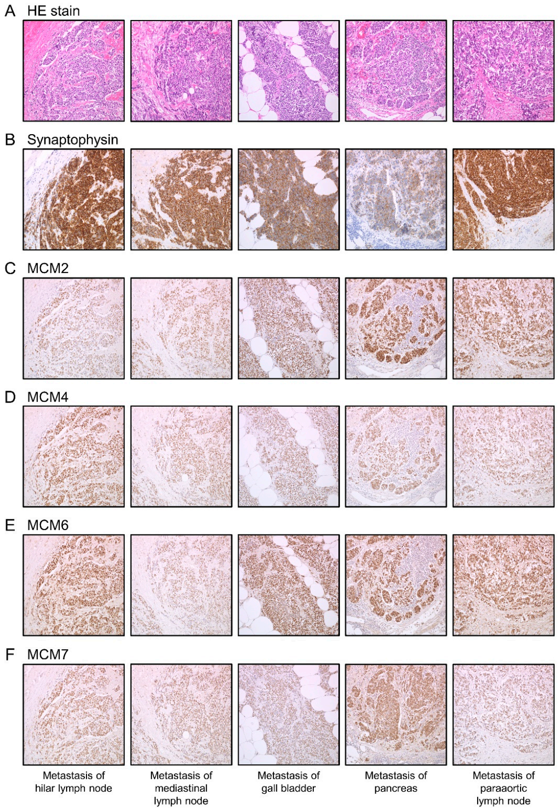 Cancers 13 01187 g003 Cancers 13 01187 g003