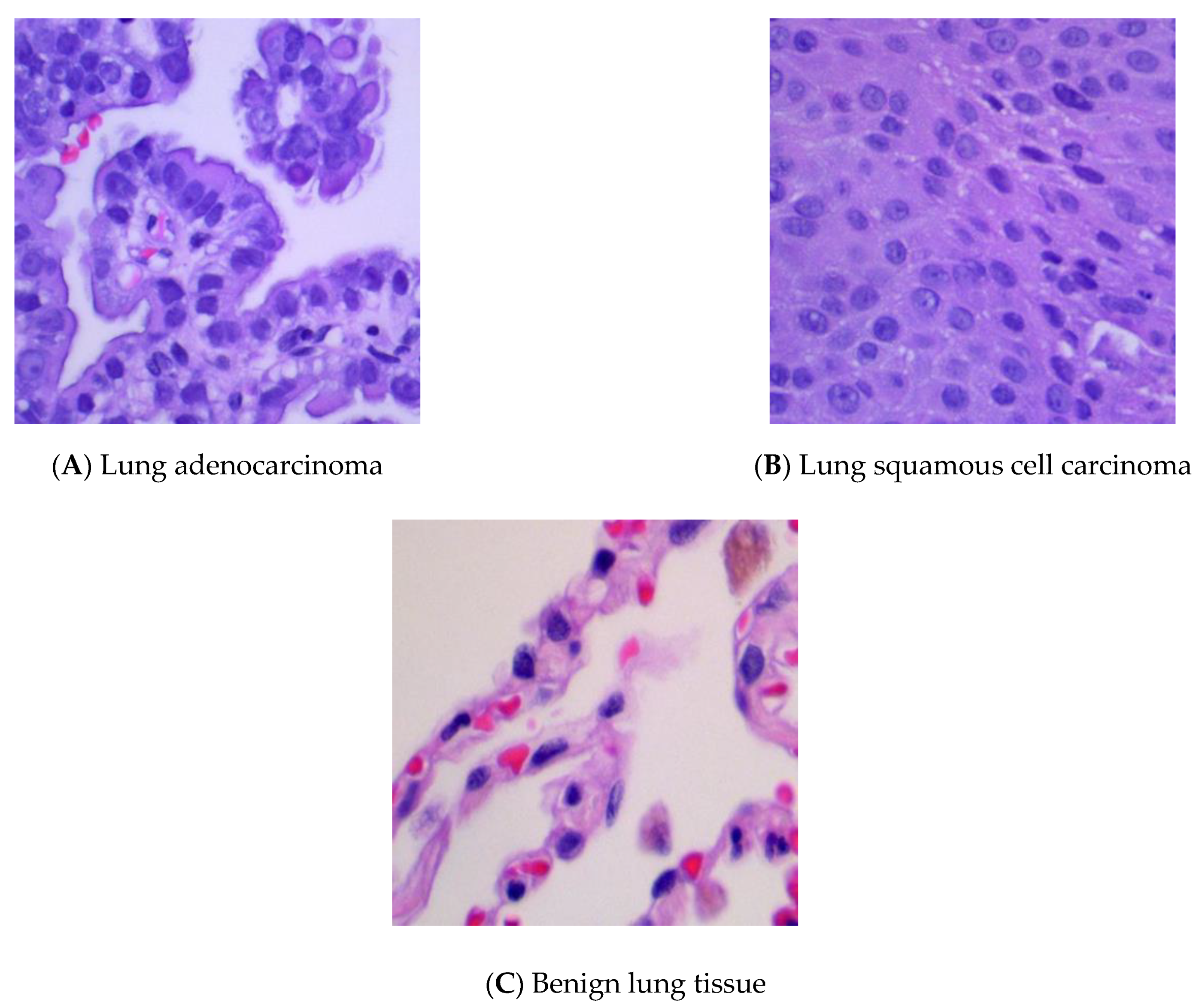 Cancers 13 01192 g002