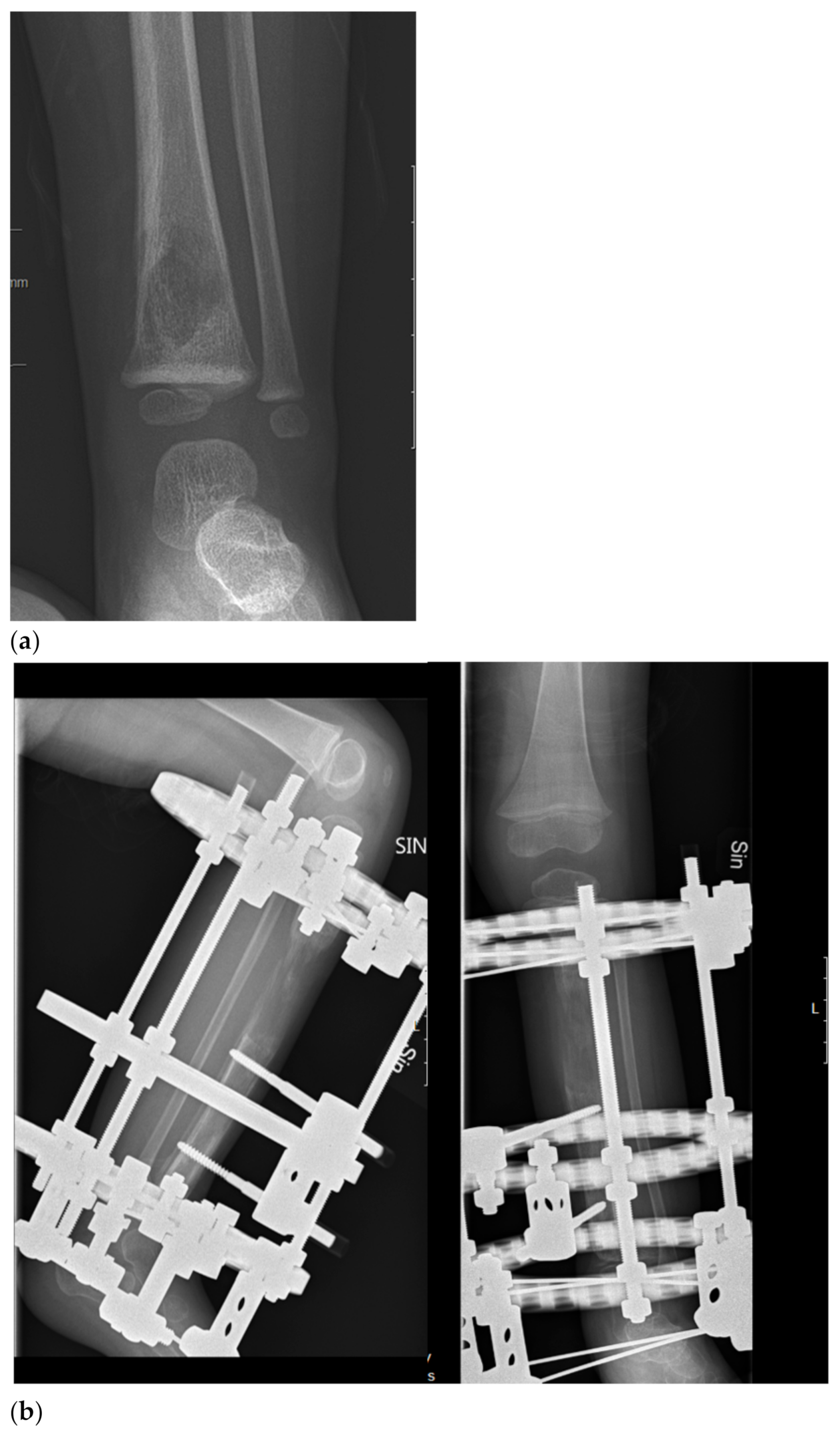 Frontiers | Multimodality imaging evaluation of nasal sinus