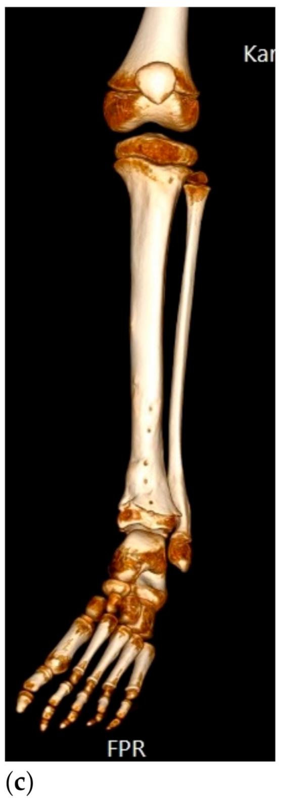 Cancers 13 01202 g001b Cancers 13 01202 g001b