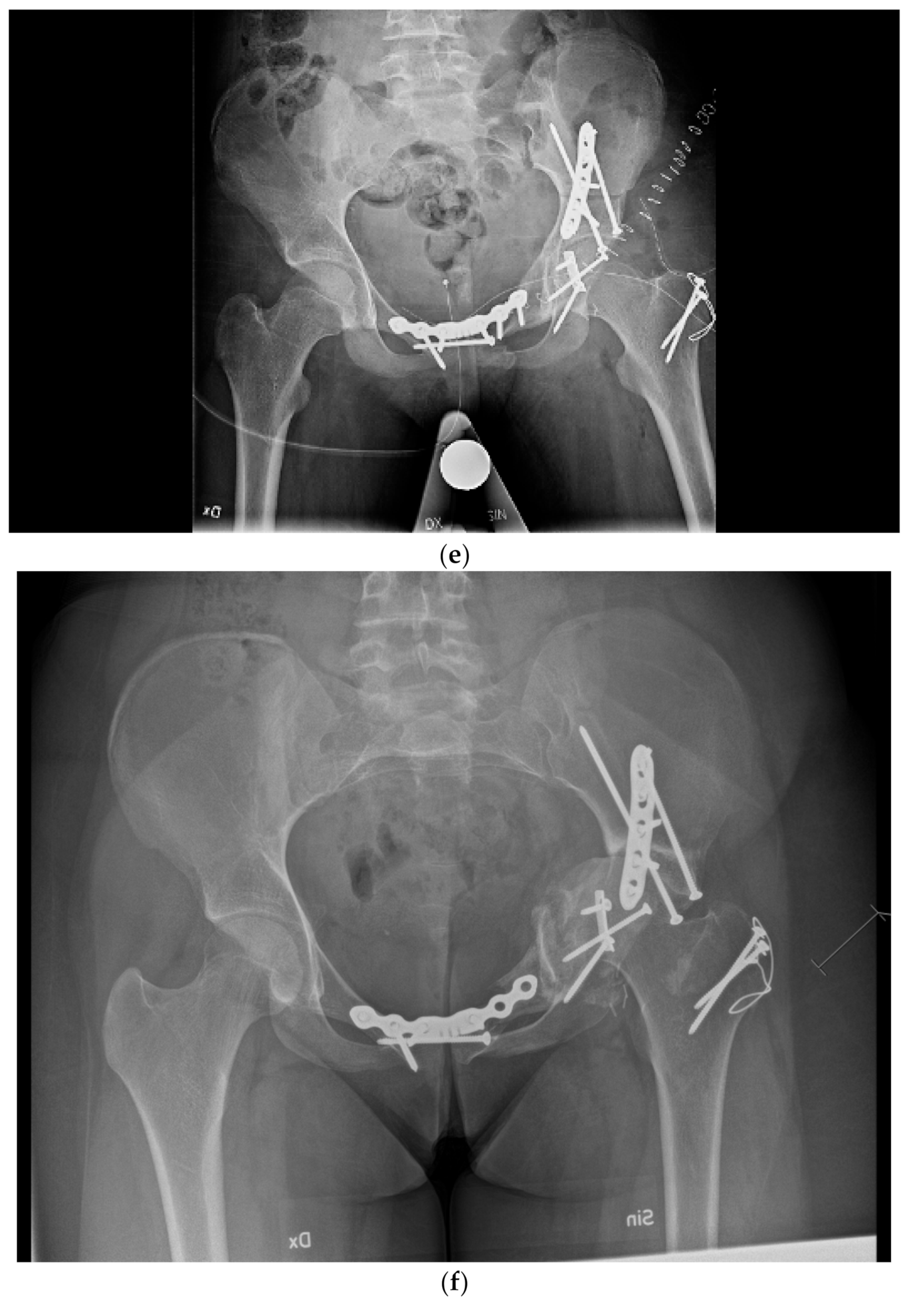 Frontiers | Multimodality imaging evaluation of nasal sinus