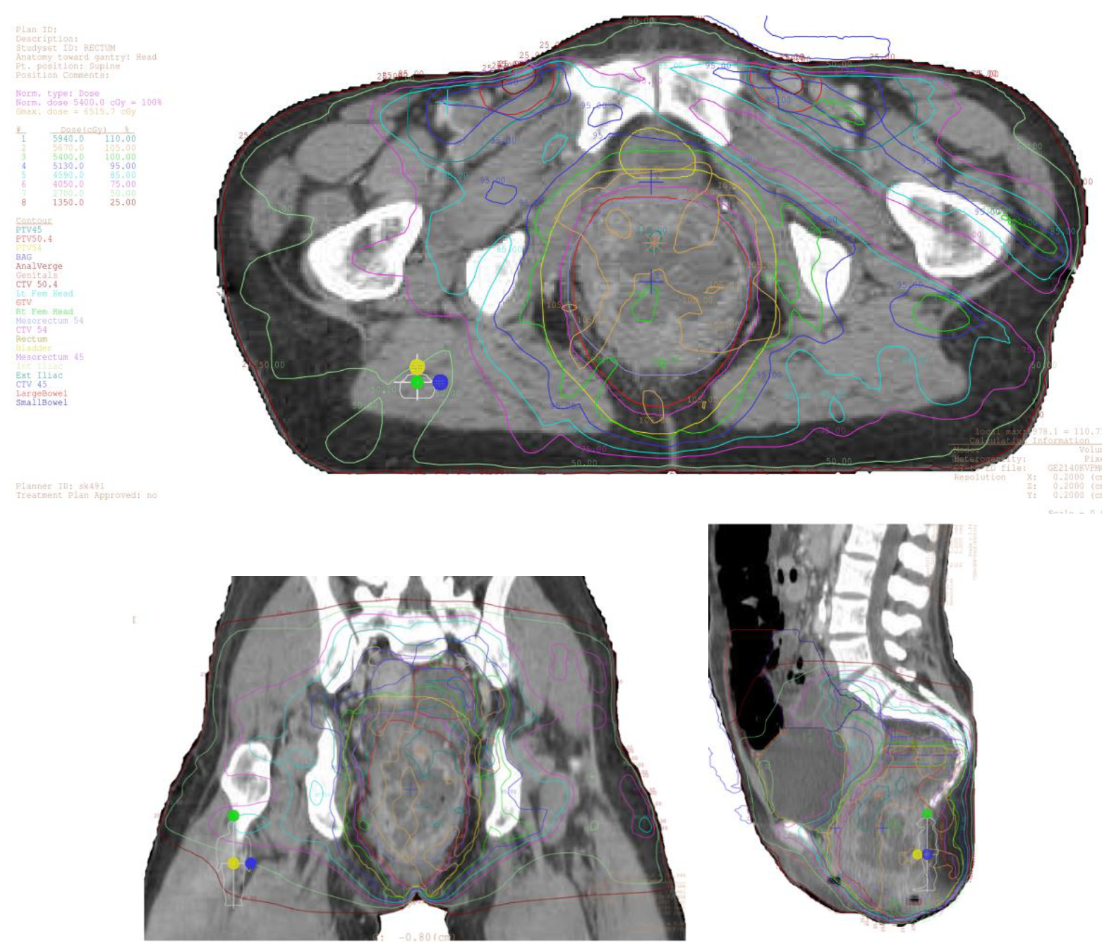 Cancers 13 01208 g001 Cancers 13 01208 g001