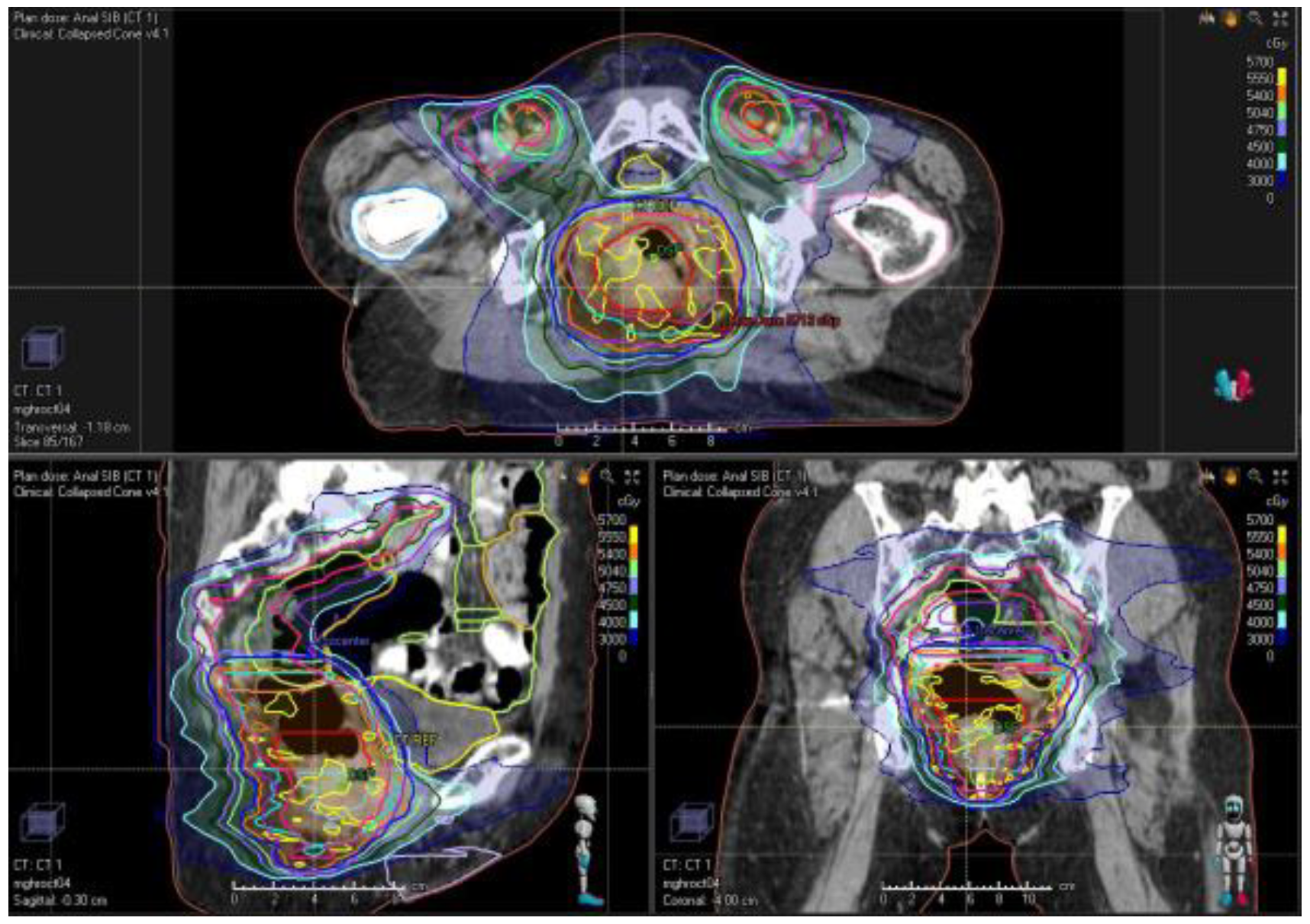 Cancers 13 01208 g002 Cancers 13 01208 g002