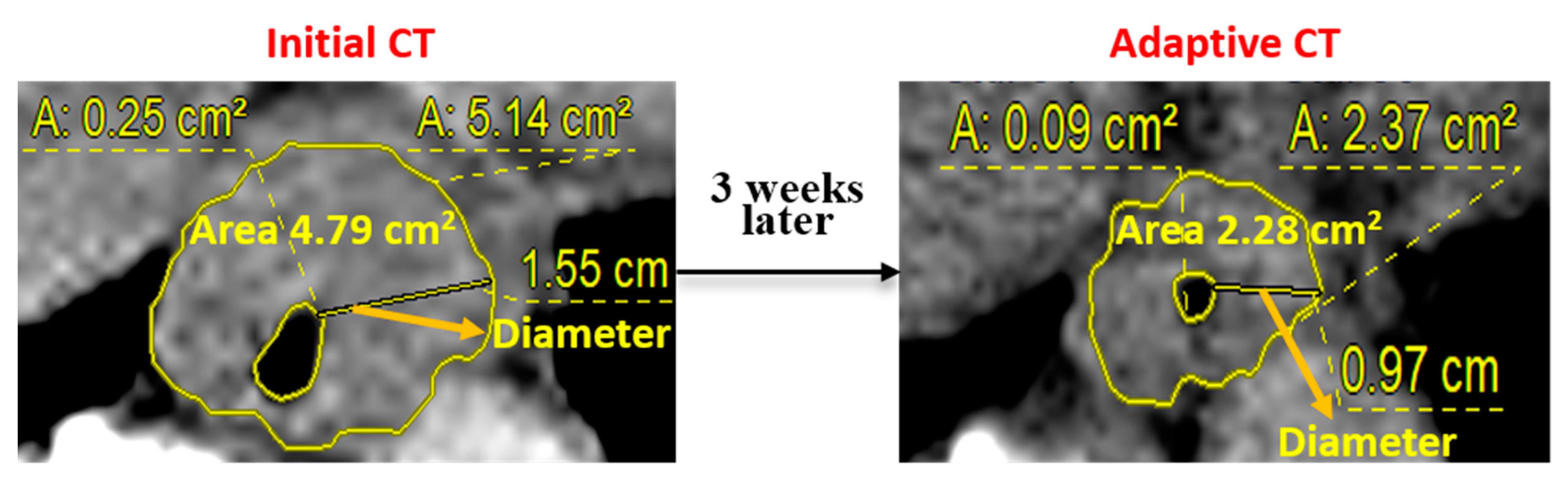 Cancers 13 01255 g001 Cancers 13 01255 g001