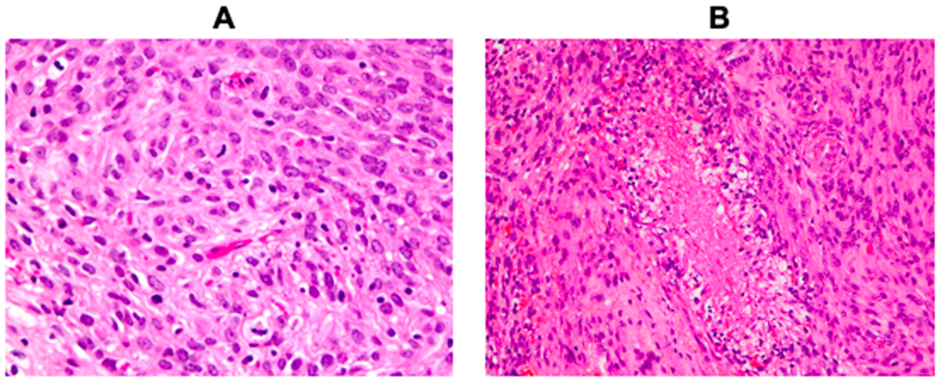 Cancers 13 01262 g001 Cancers 13 01262 g001