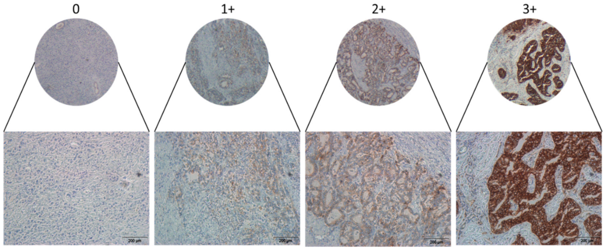 Cancers 13 01286 g002 Cancers 13 01286 g002