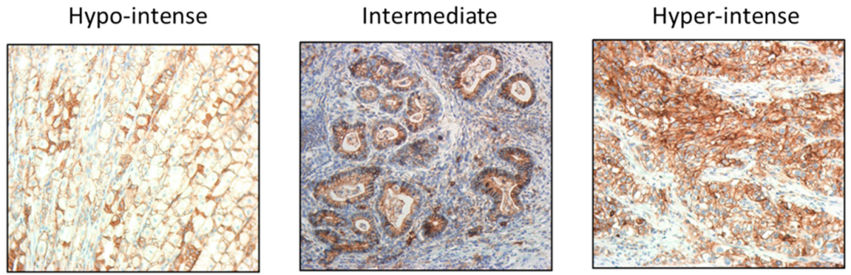 Cancers 13 01286 g004 Cancers 13 01286 g004