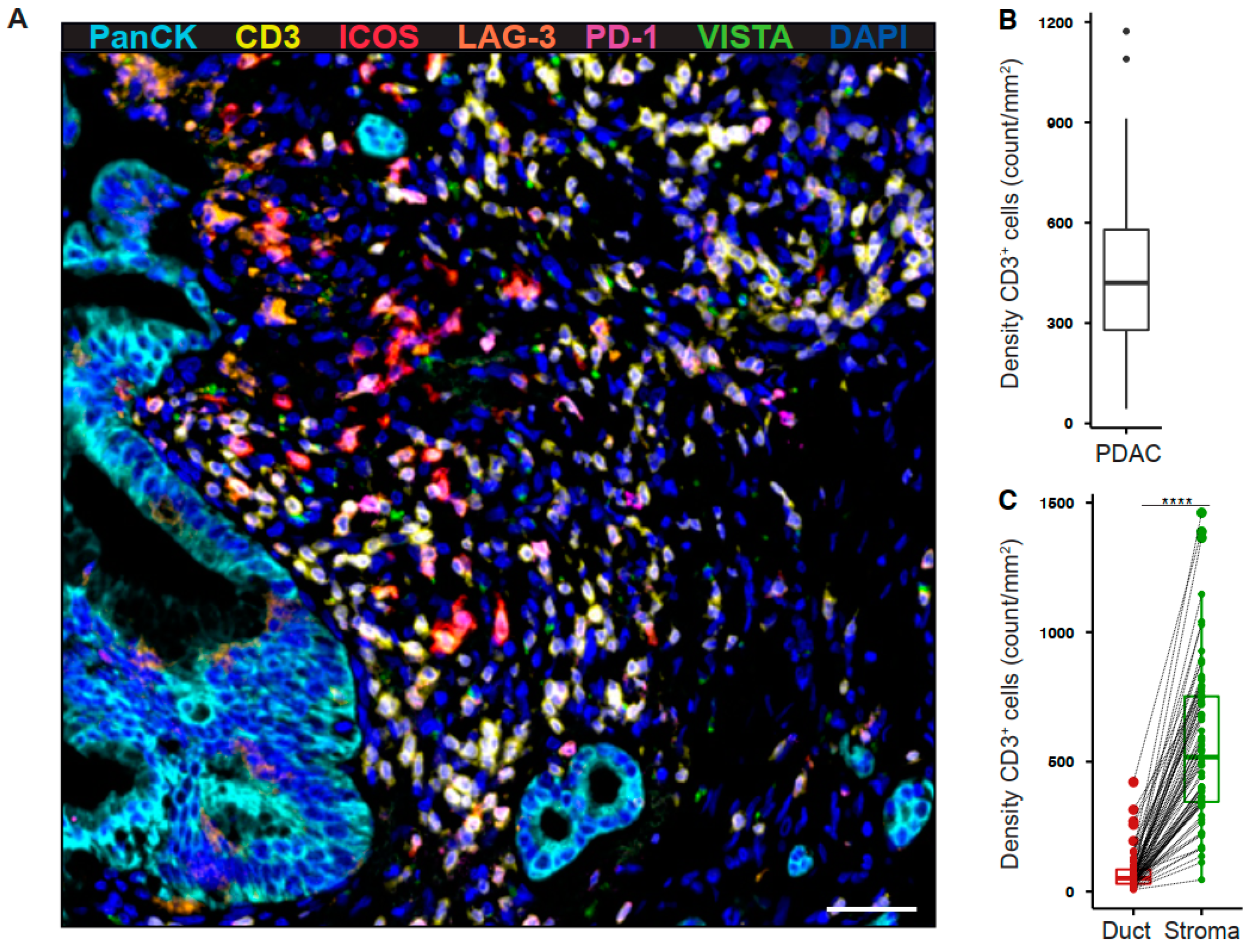 Papiloma krema novi sad - Pancreatic cancer vista