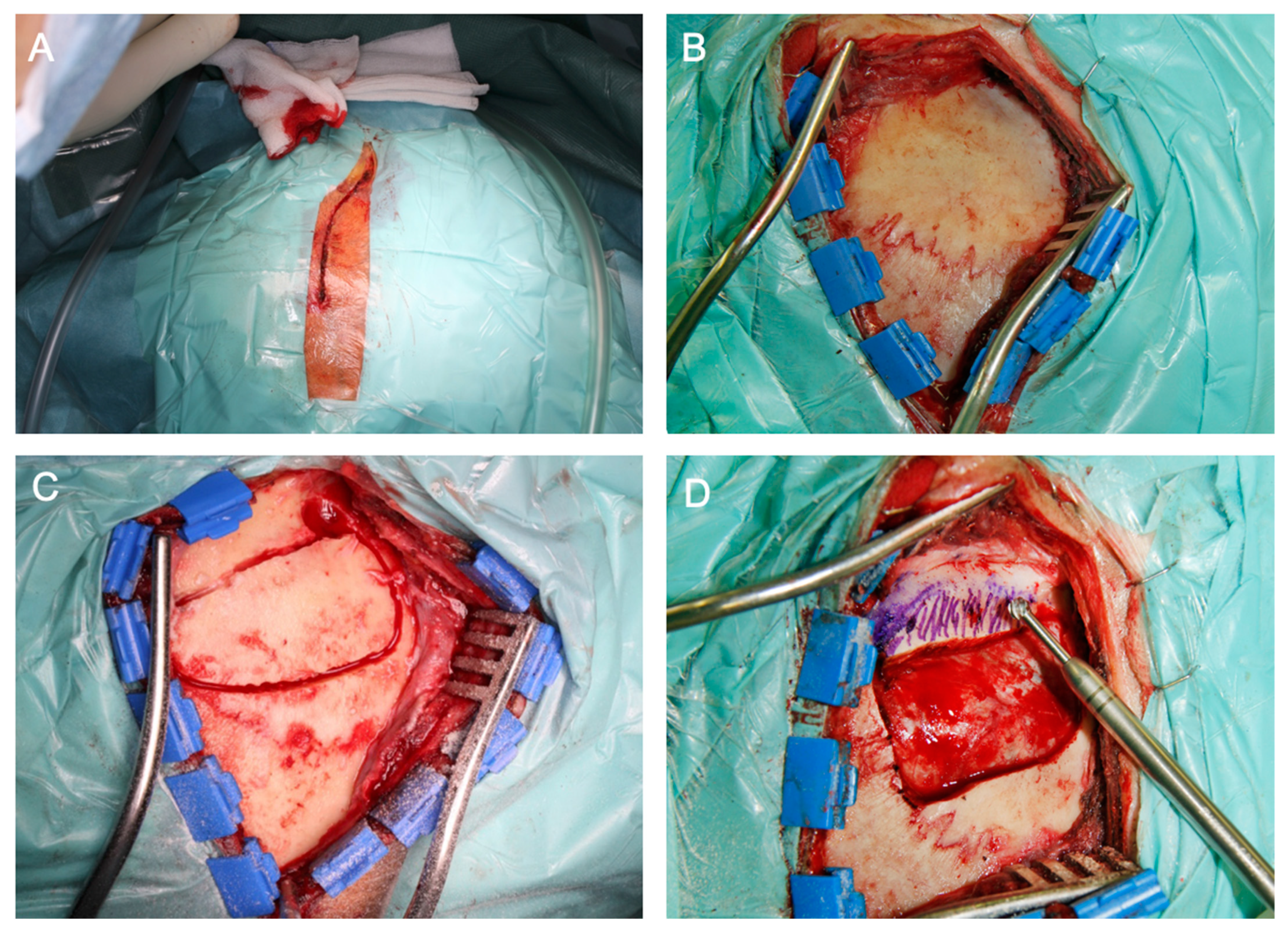 Cancers 13 01310 g003