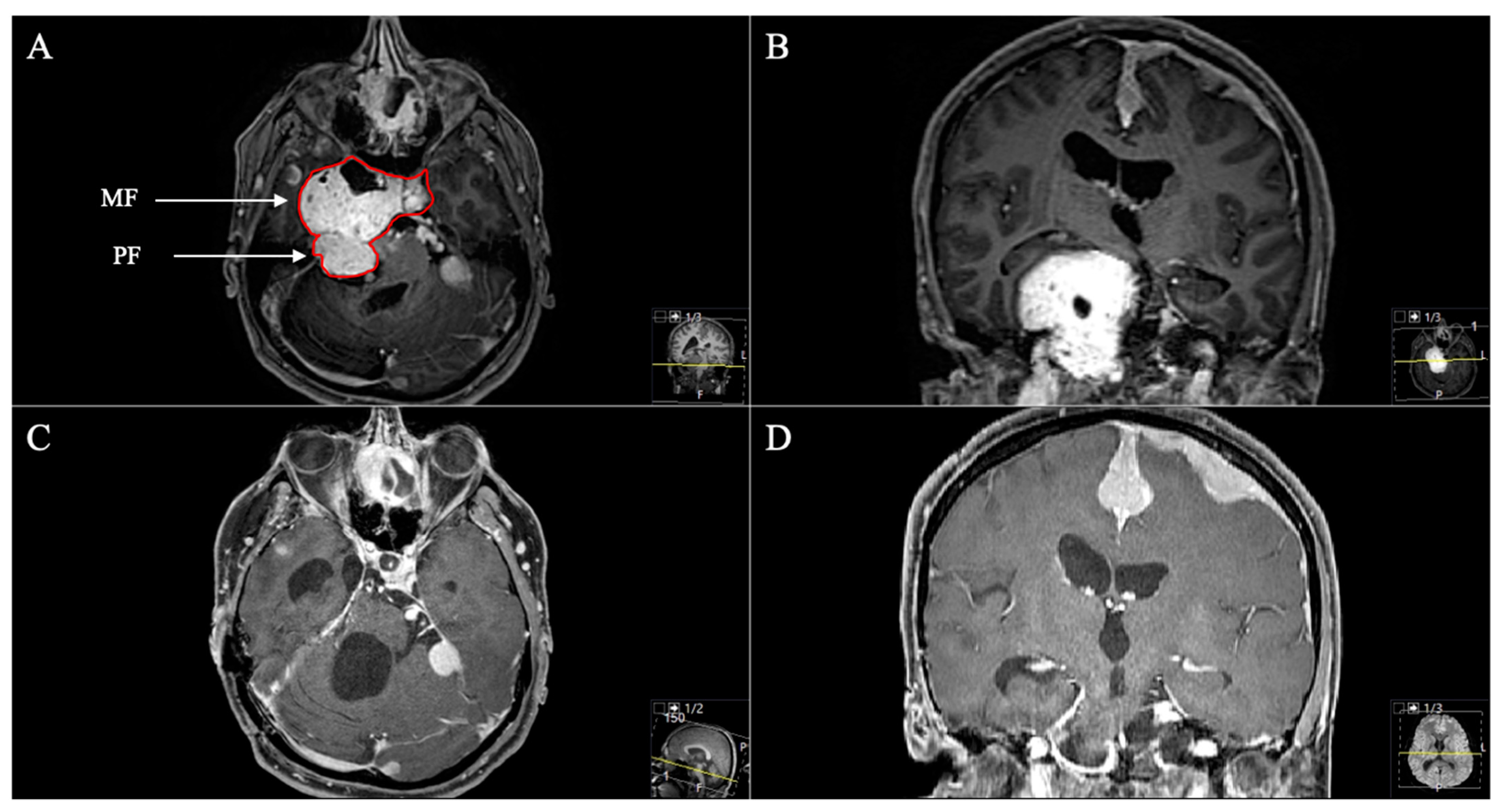 Cancers 13 01310 g004