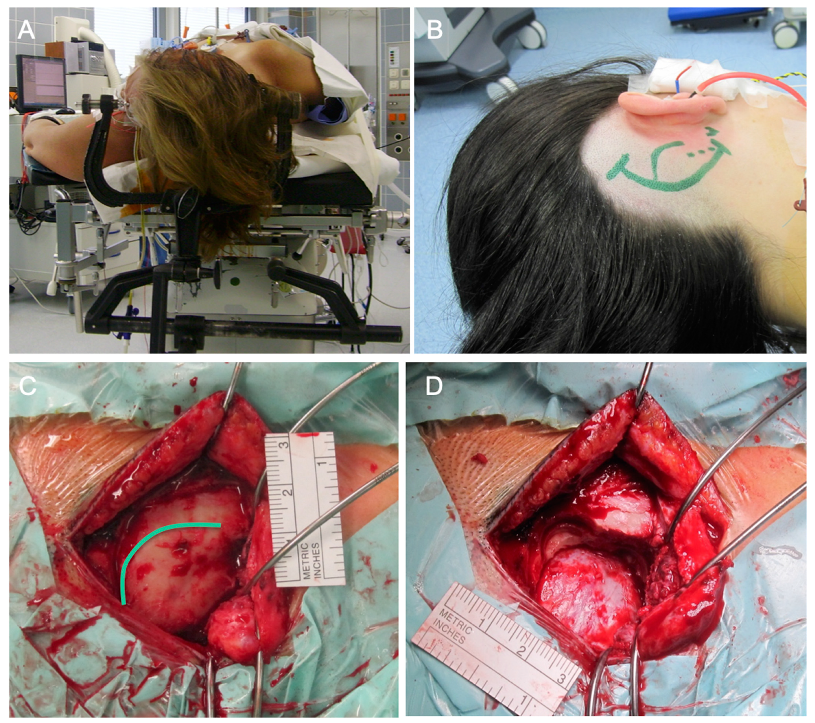 Cancers 13 01310 g005