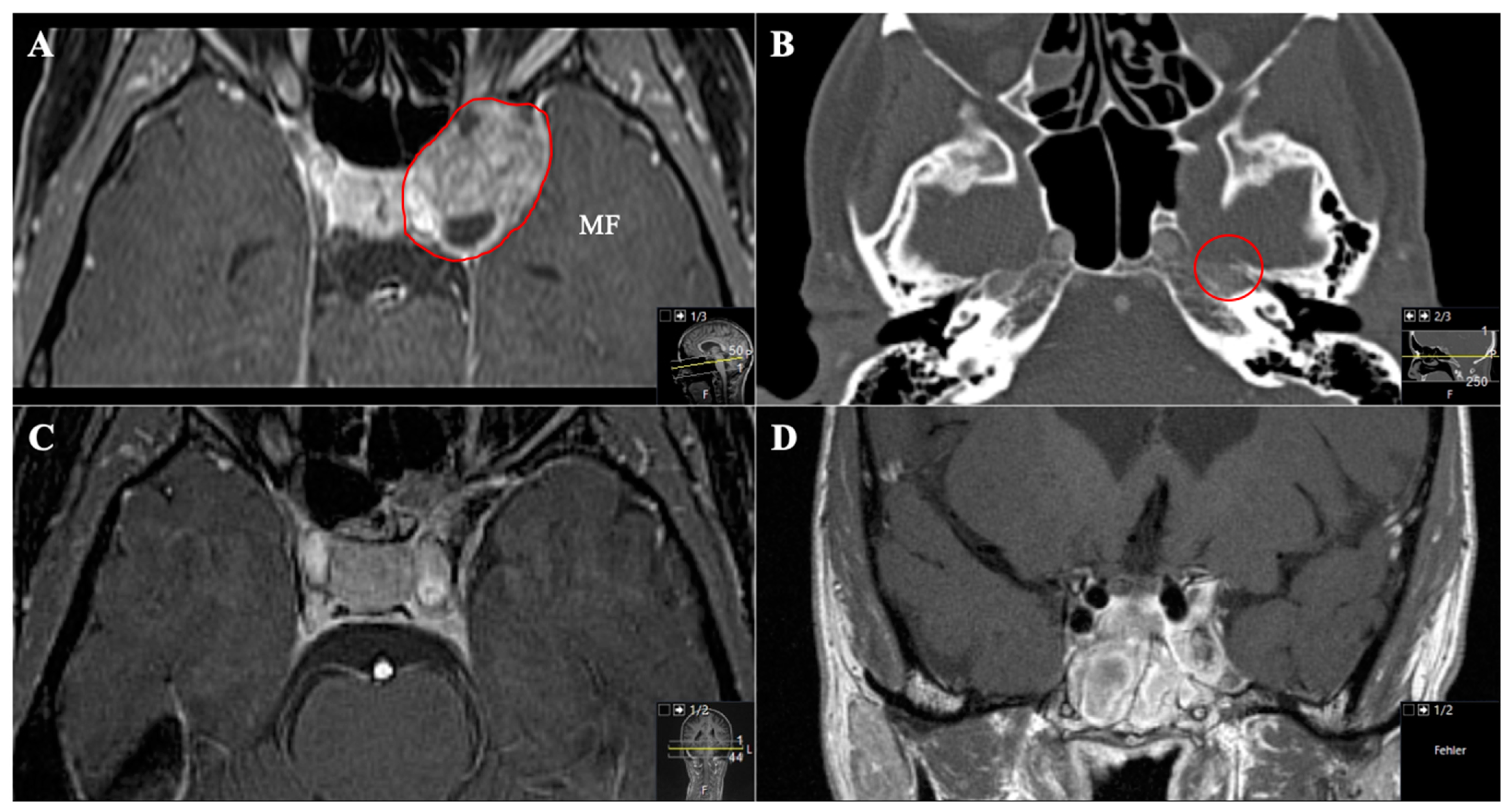 Cancers 13 01310 g007