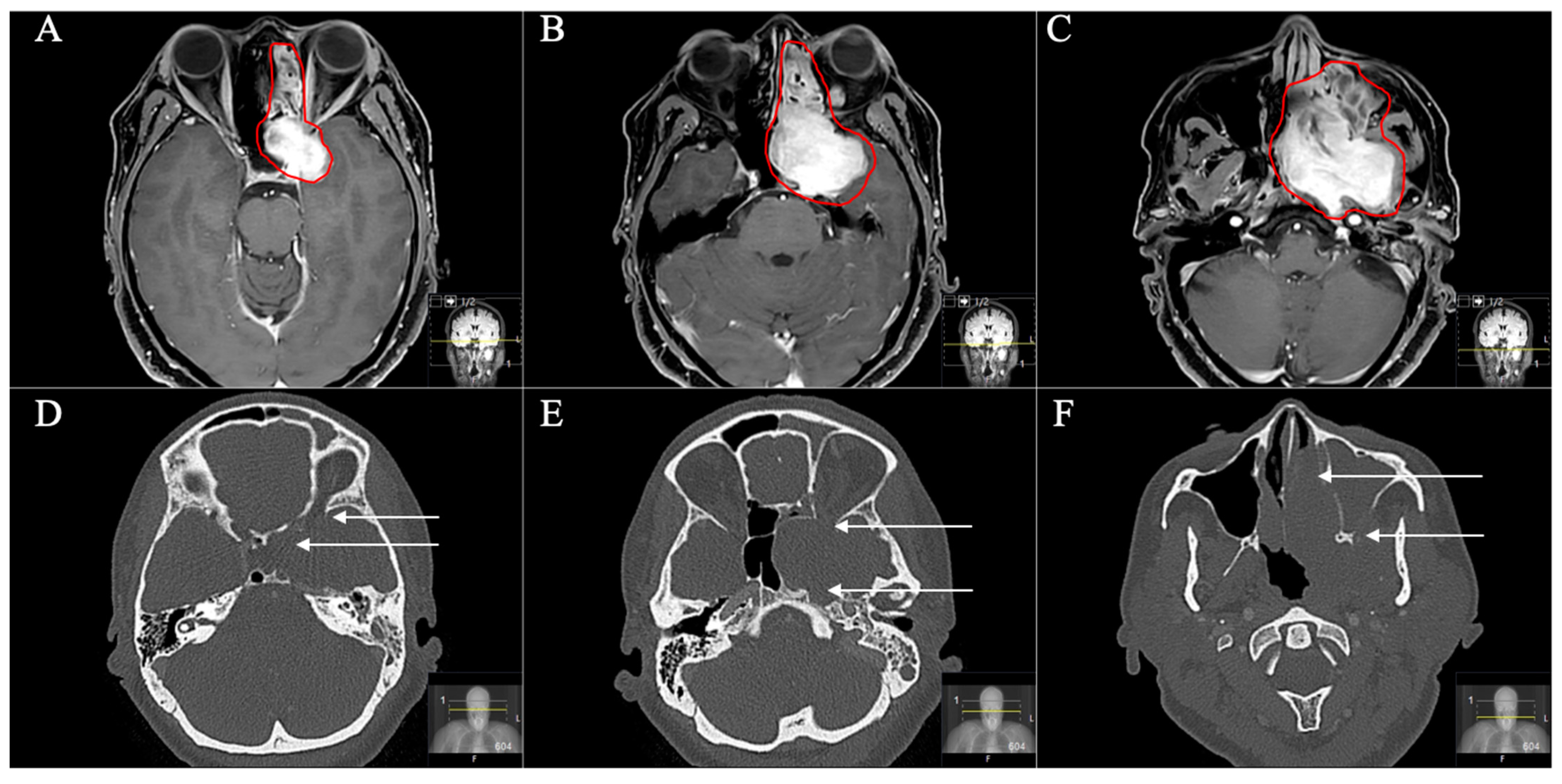 Cancers 13 01310 g009