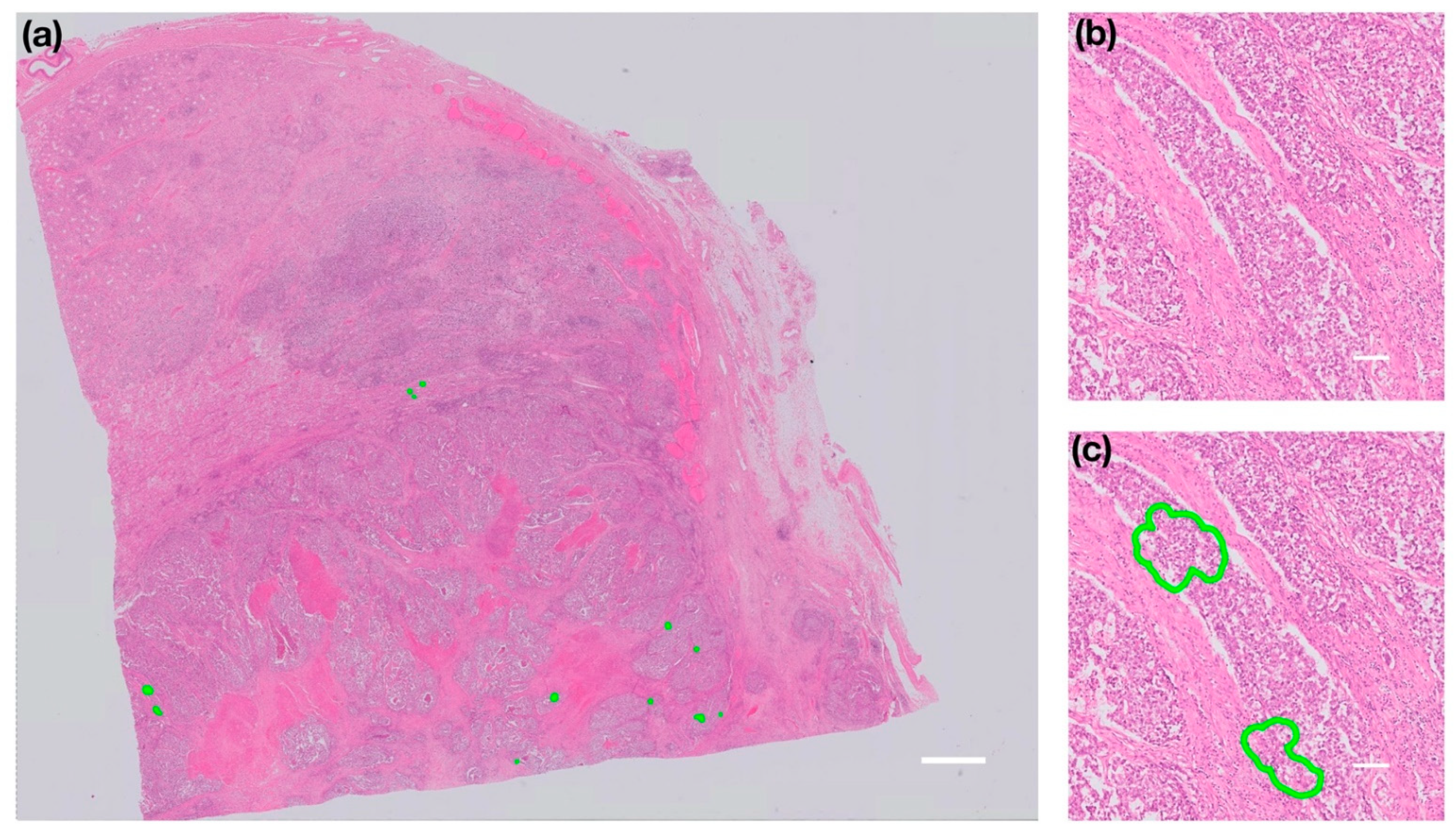 Cancers 13 01325 g003