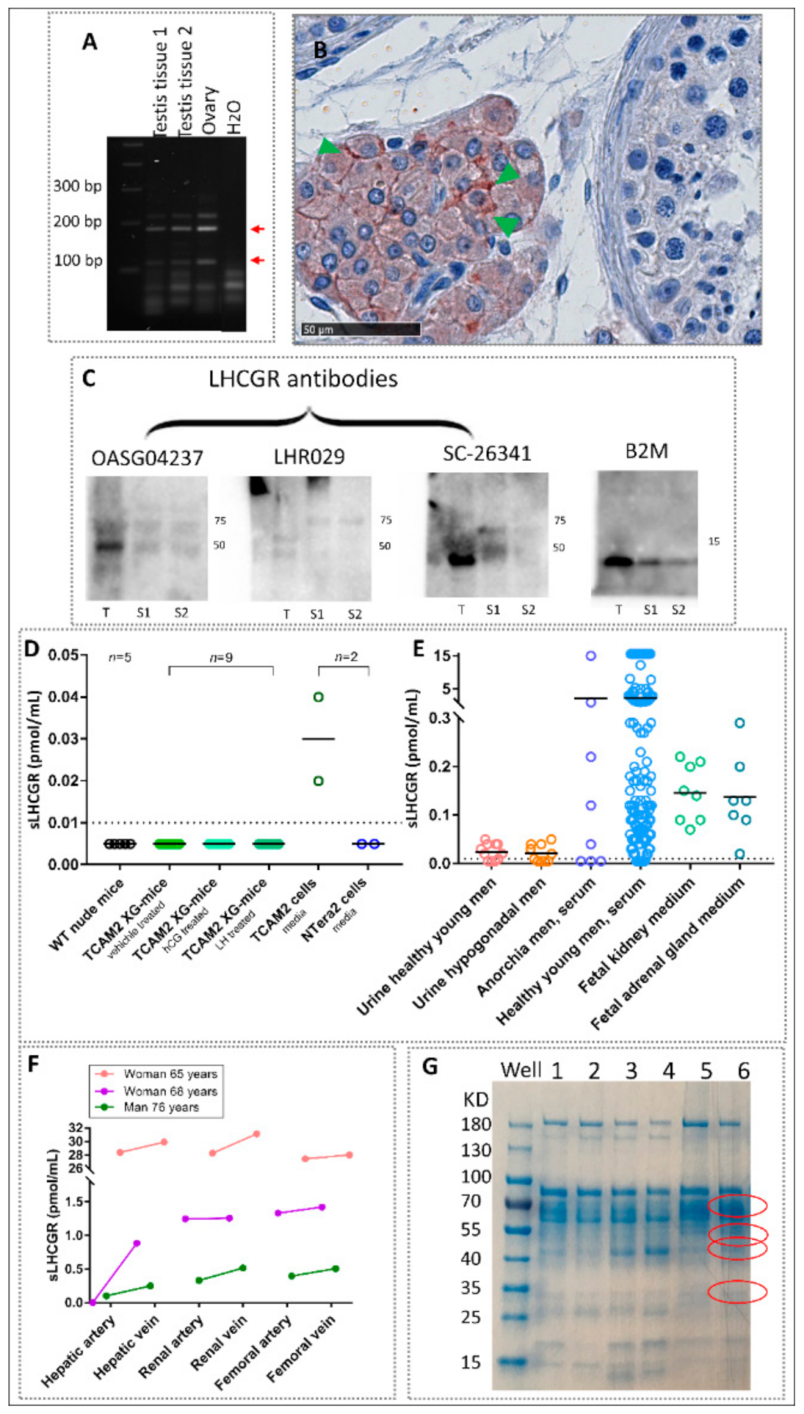Cancers 13 01329 g001 Cancers 13 01329 g001