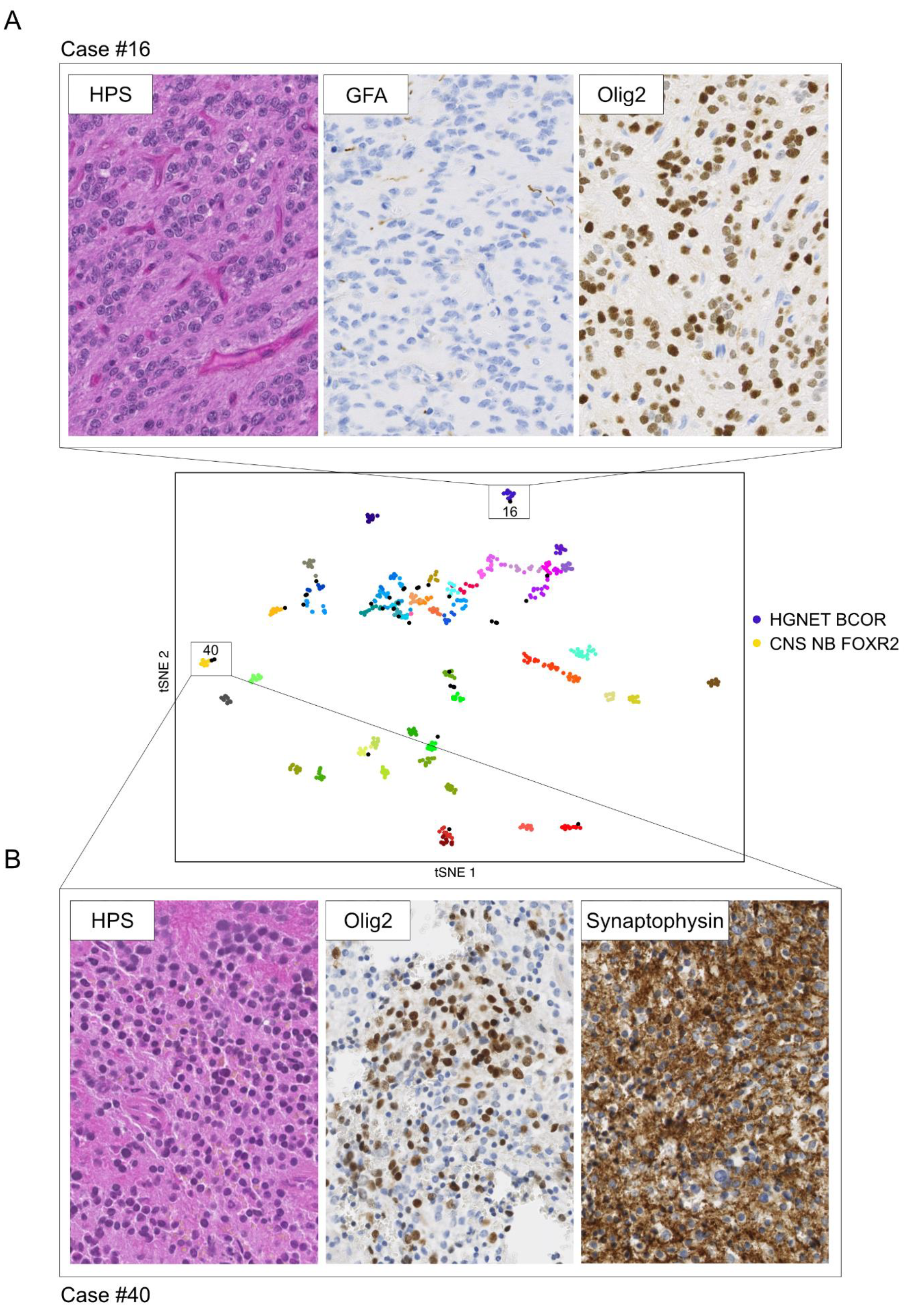 Cancers 13 01377 g003 Cancers 13 01377 g003
