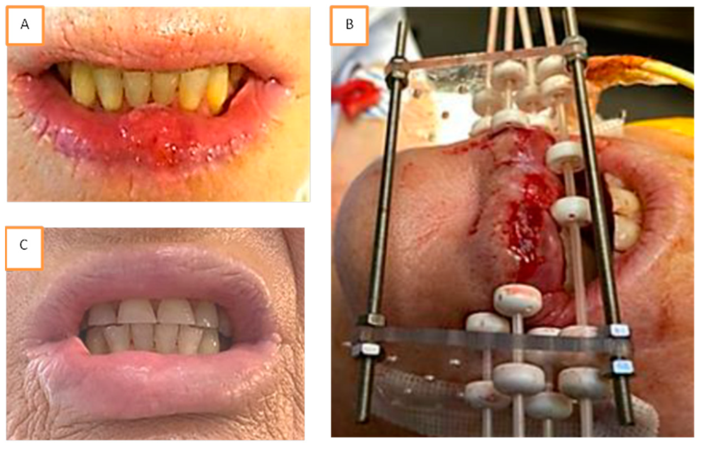 Cancers 13 01387 g001 Cancers 13 01387 g001