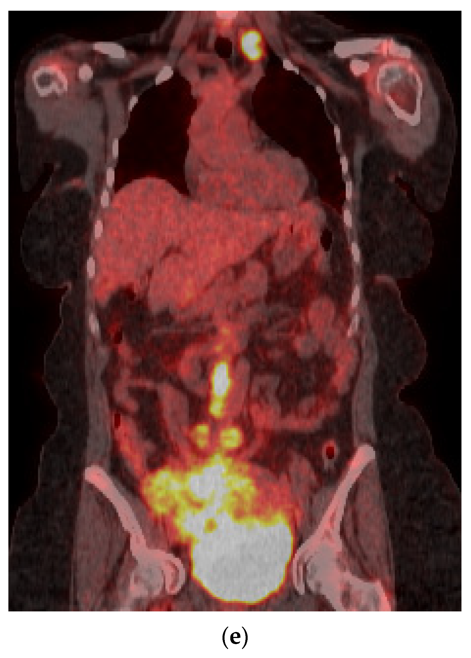 Cancers 13 01396 g007b