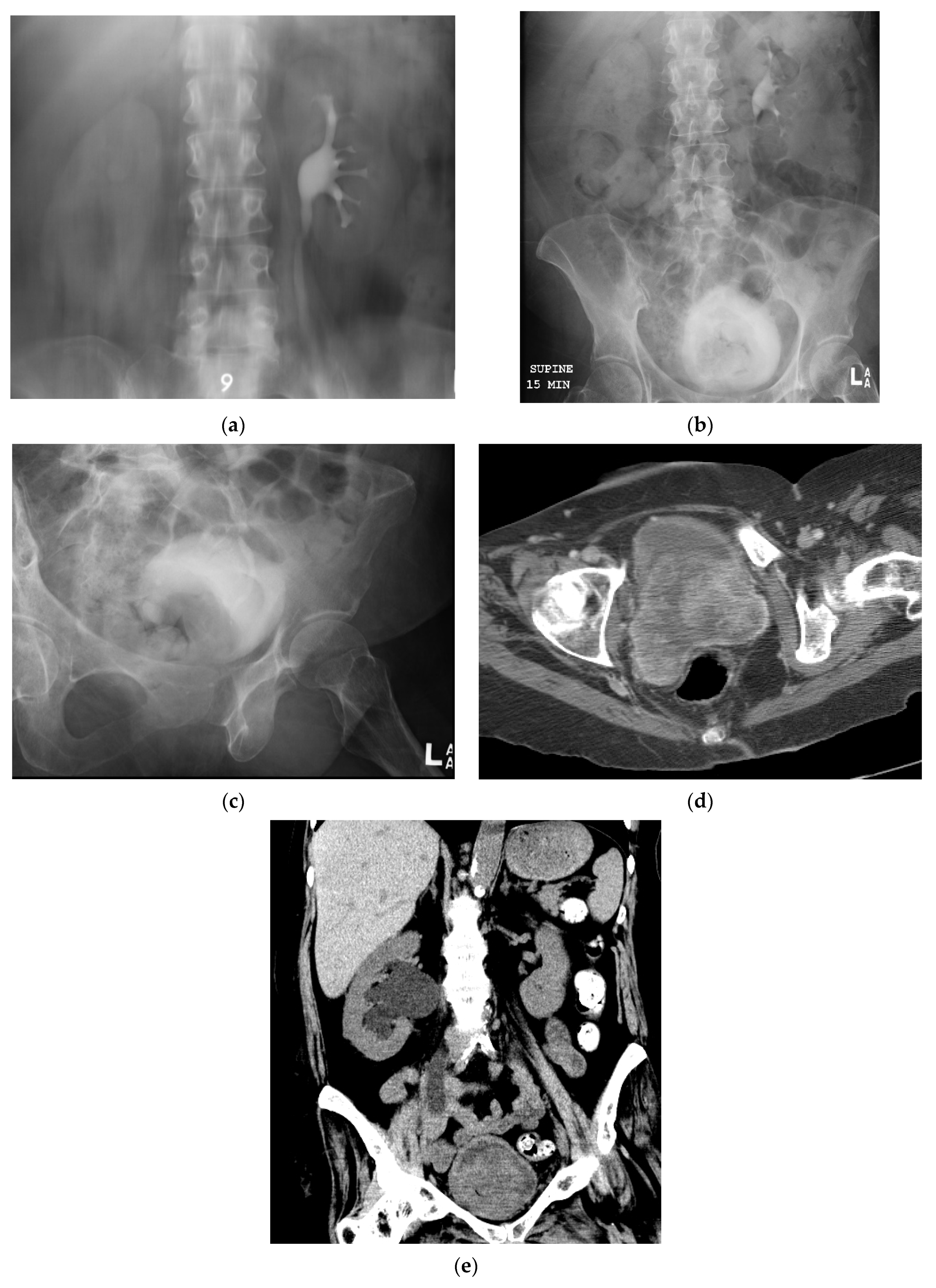 Cancers 13 01396 g009