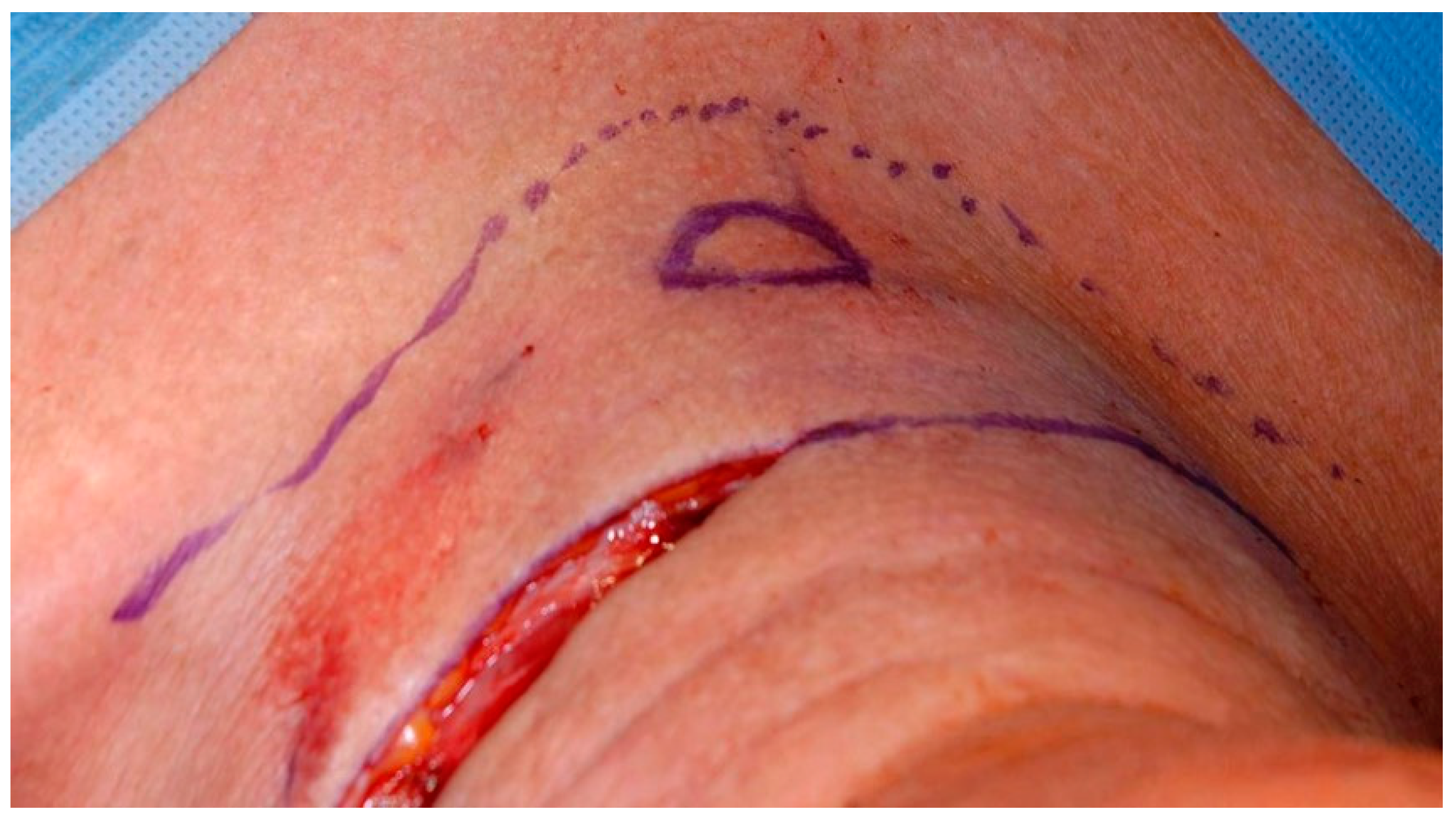 Cancers 13 01405 g002 Cancers 13 01405 g002