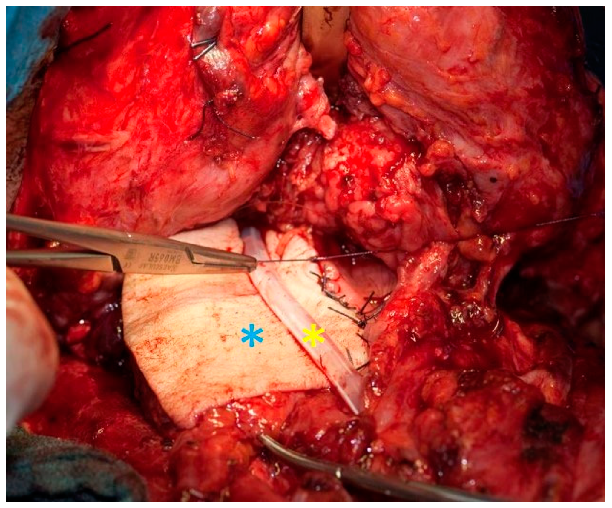 Cancers 13 01405 g003 Cancers 13 01405 g003