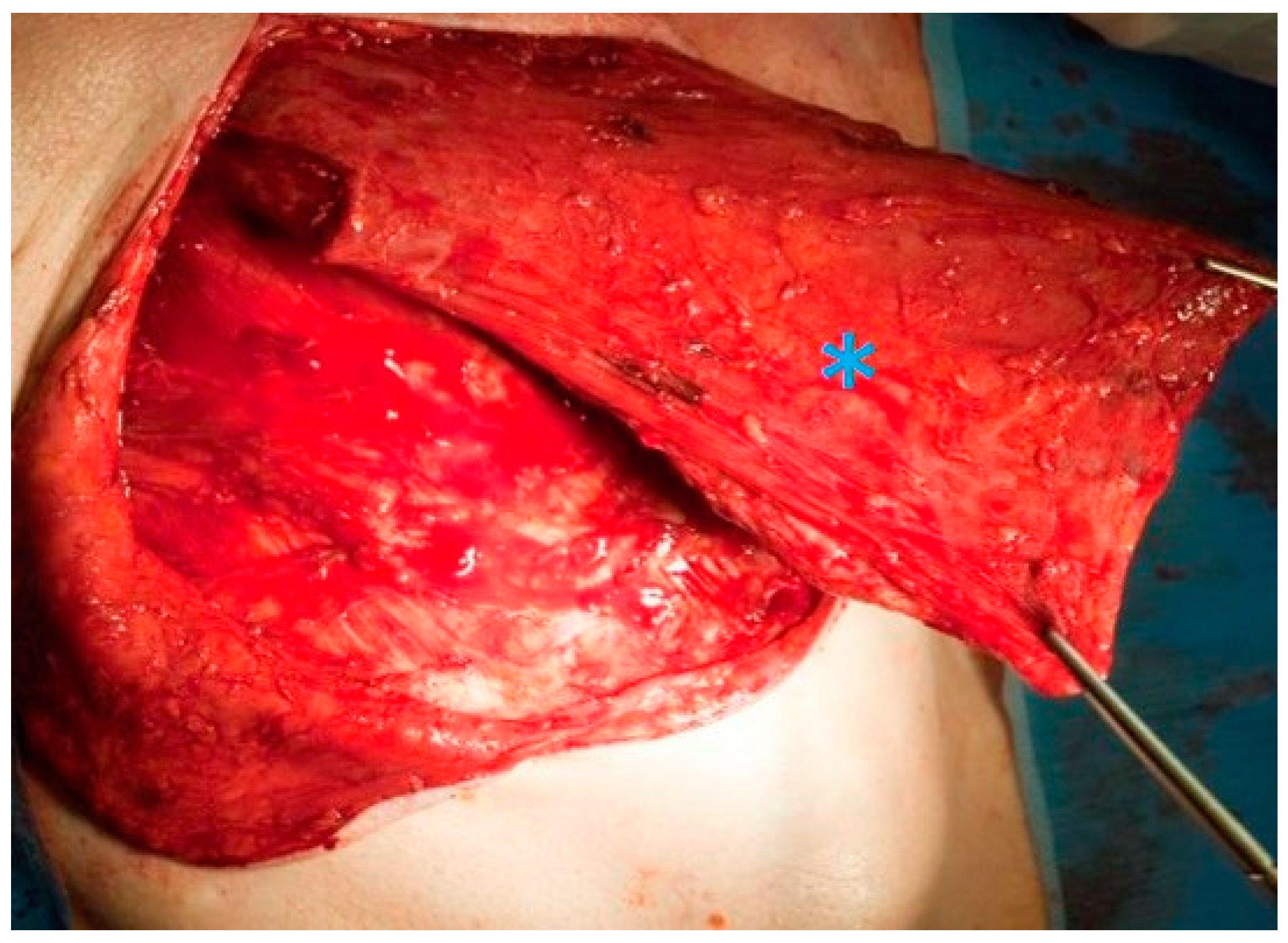 Cancers 13 01405 g004 Cancers 13 01405 g004