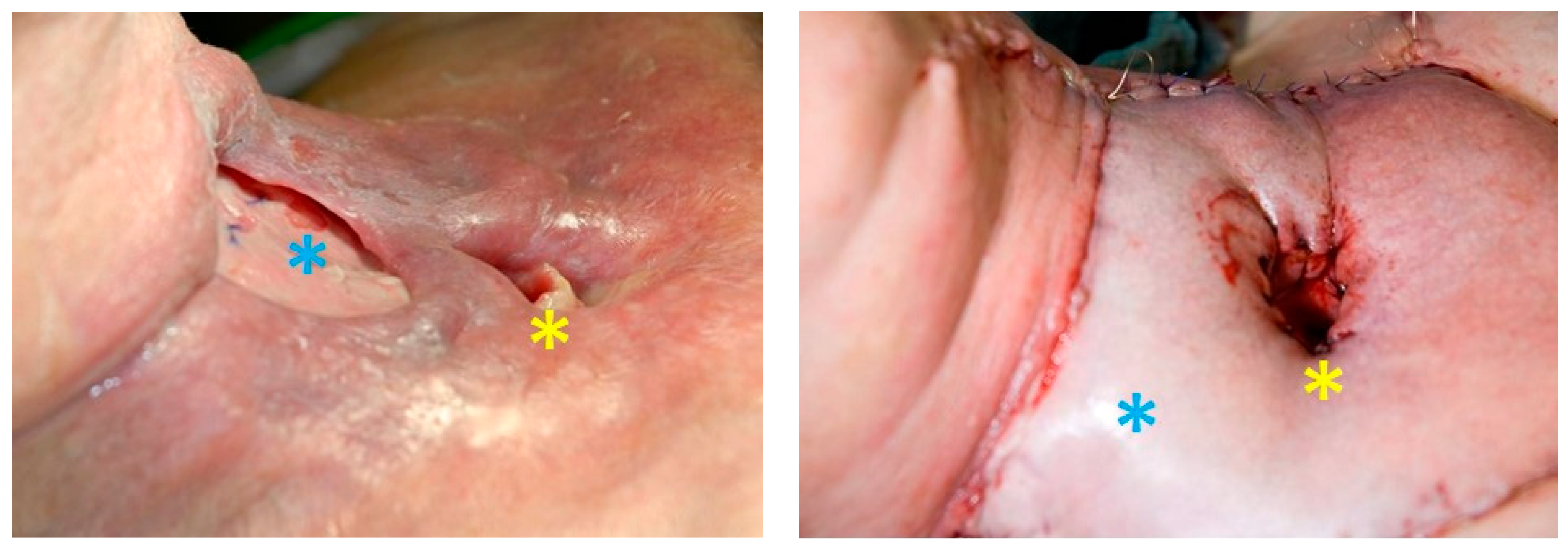 Cancers 13 01405 g005 Cancers 13 01405 g005