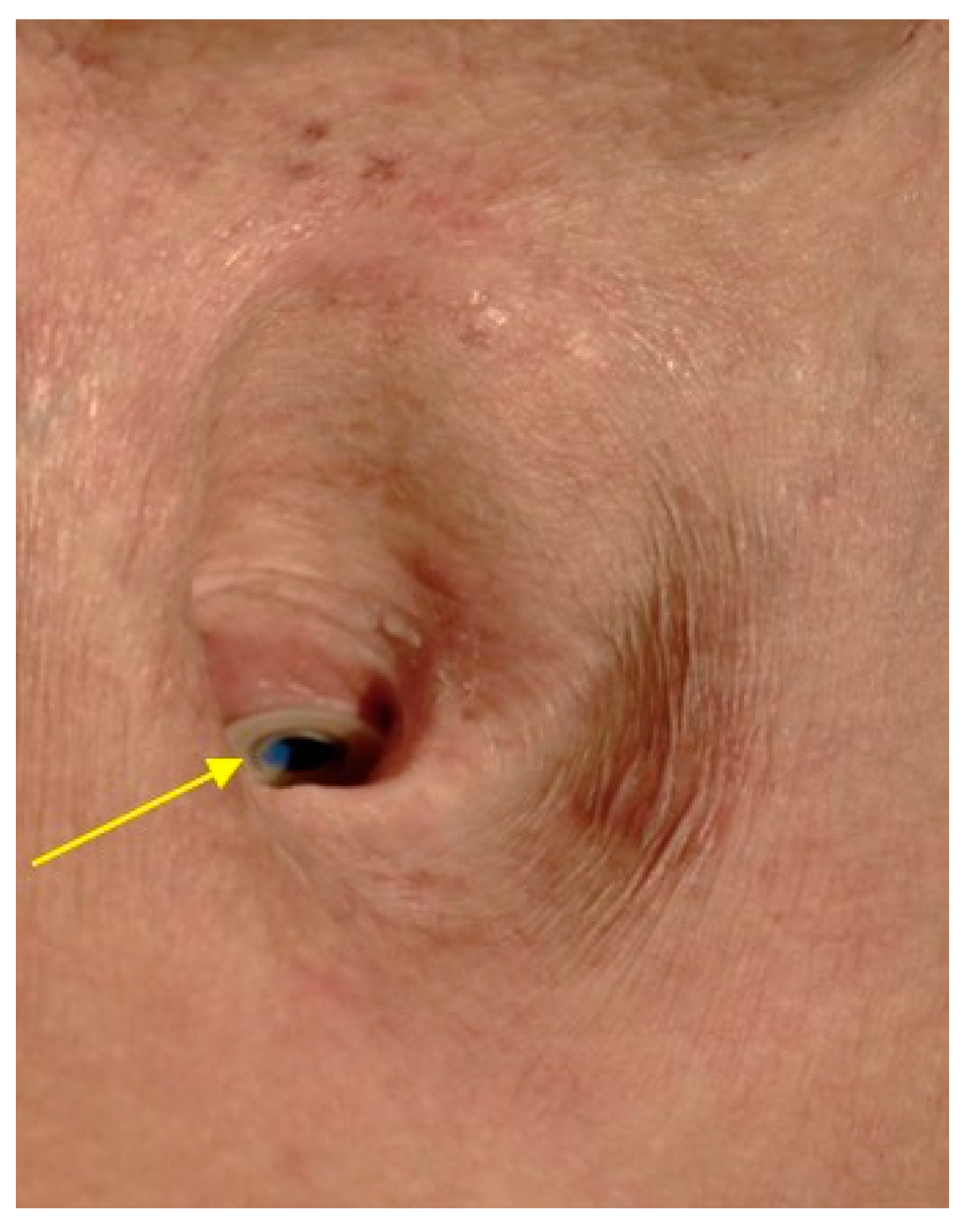 Cancers 13 01405 g006 Cancers 13 01405 g006