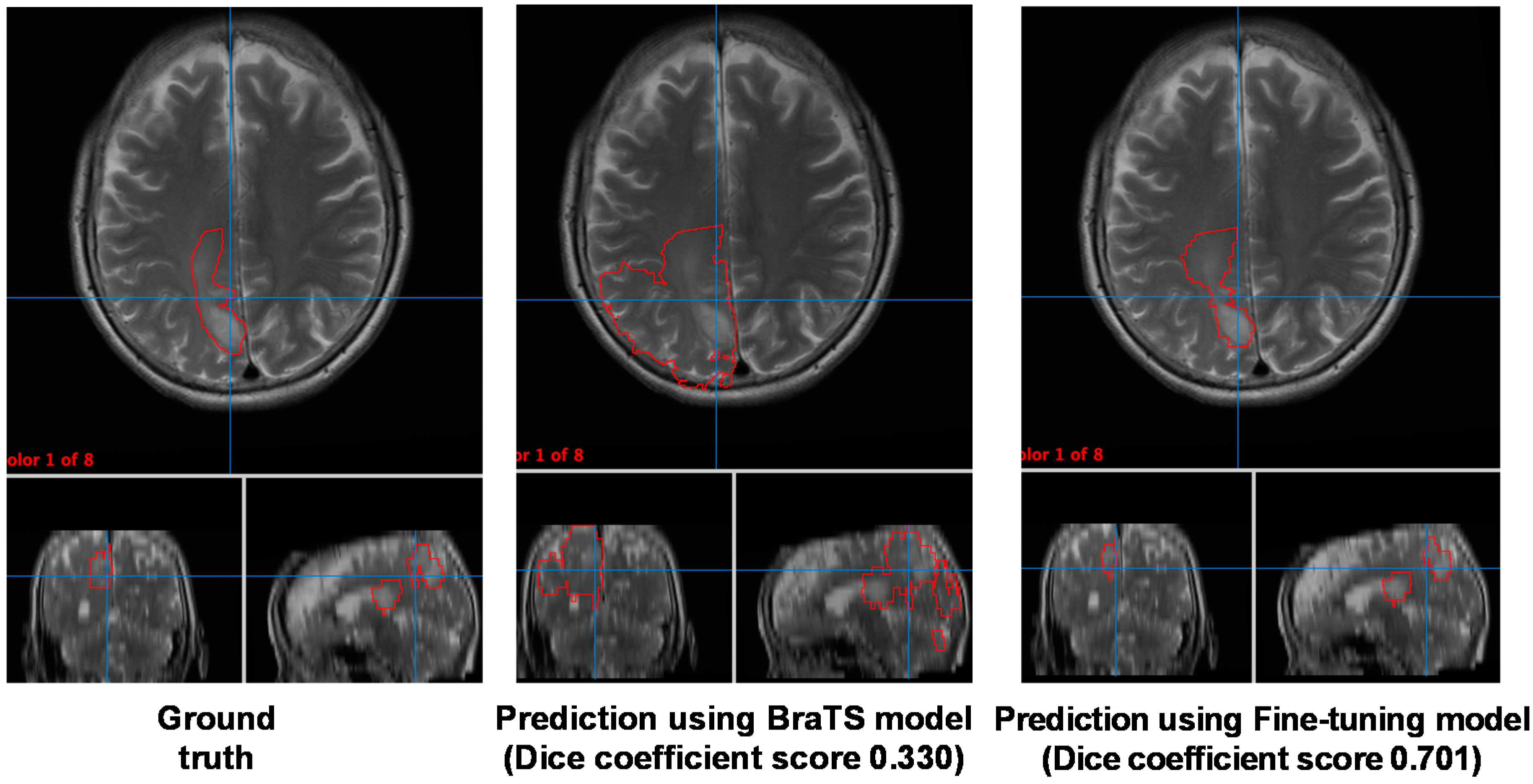 Cancers 13 01415 g004 Cancers 13 01415 g004