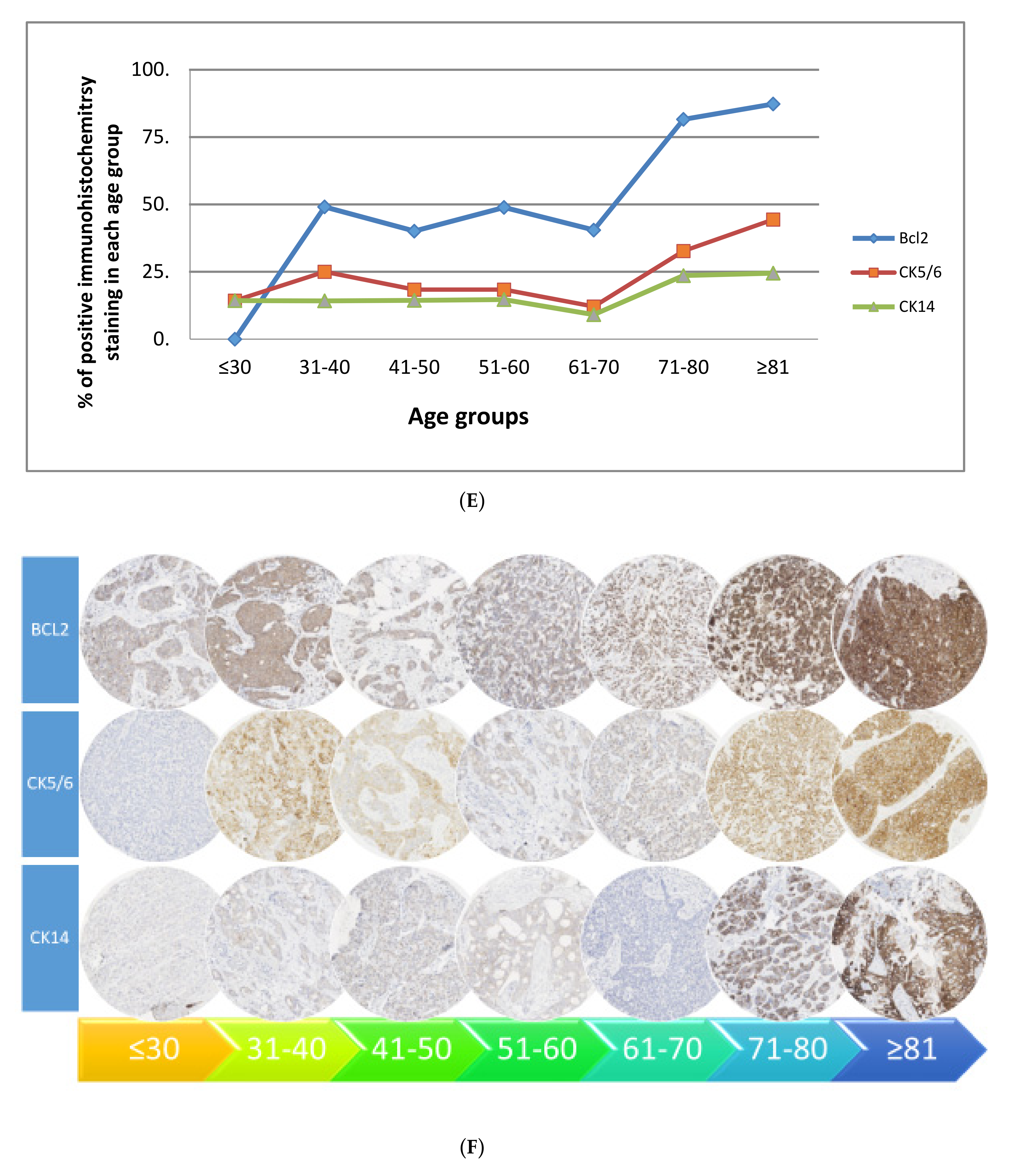Age-Related Biology of Early-Stage Operable Breast Cancer