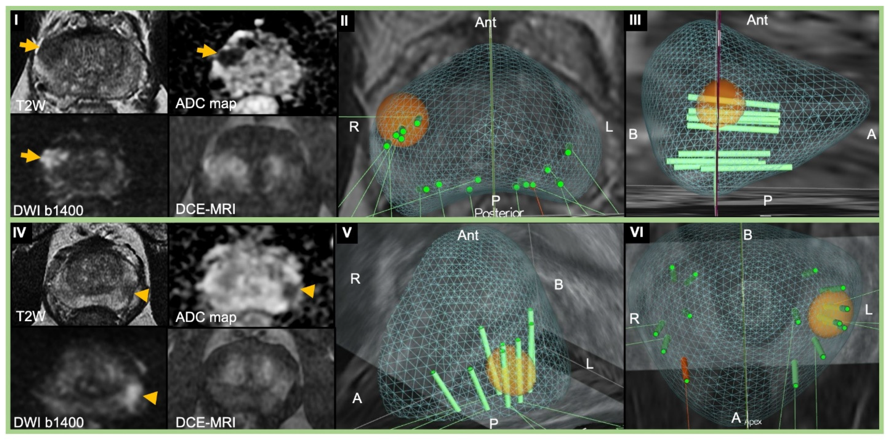 Cancers 13 01449 g001