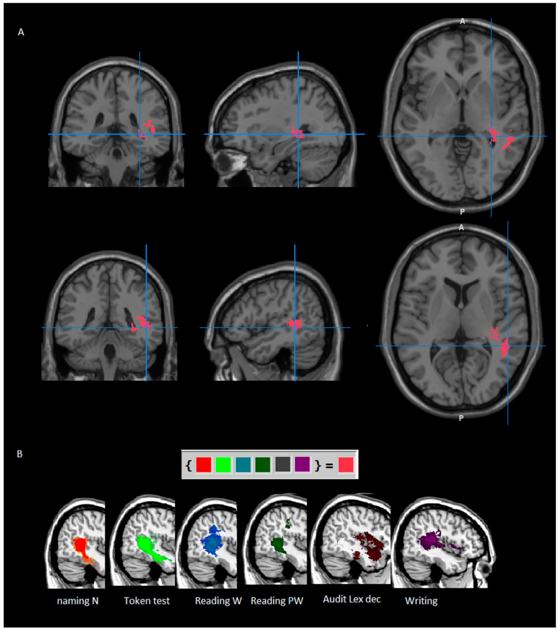 Cancers 13 01467 g003 Cancers 13 01467 g003