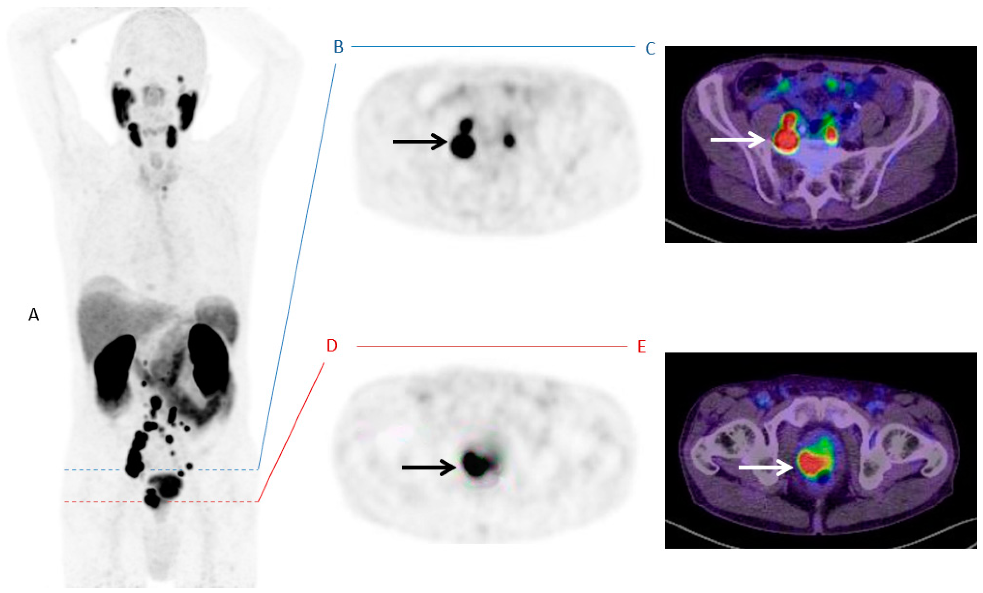 Cancers 13 01508 g003 Cancers 13 01508 g003
