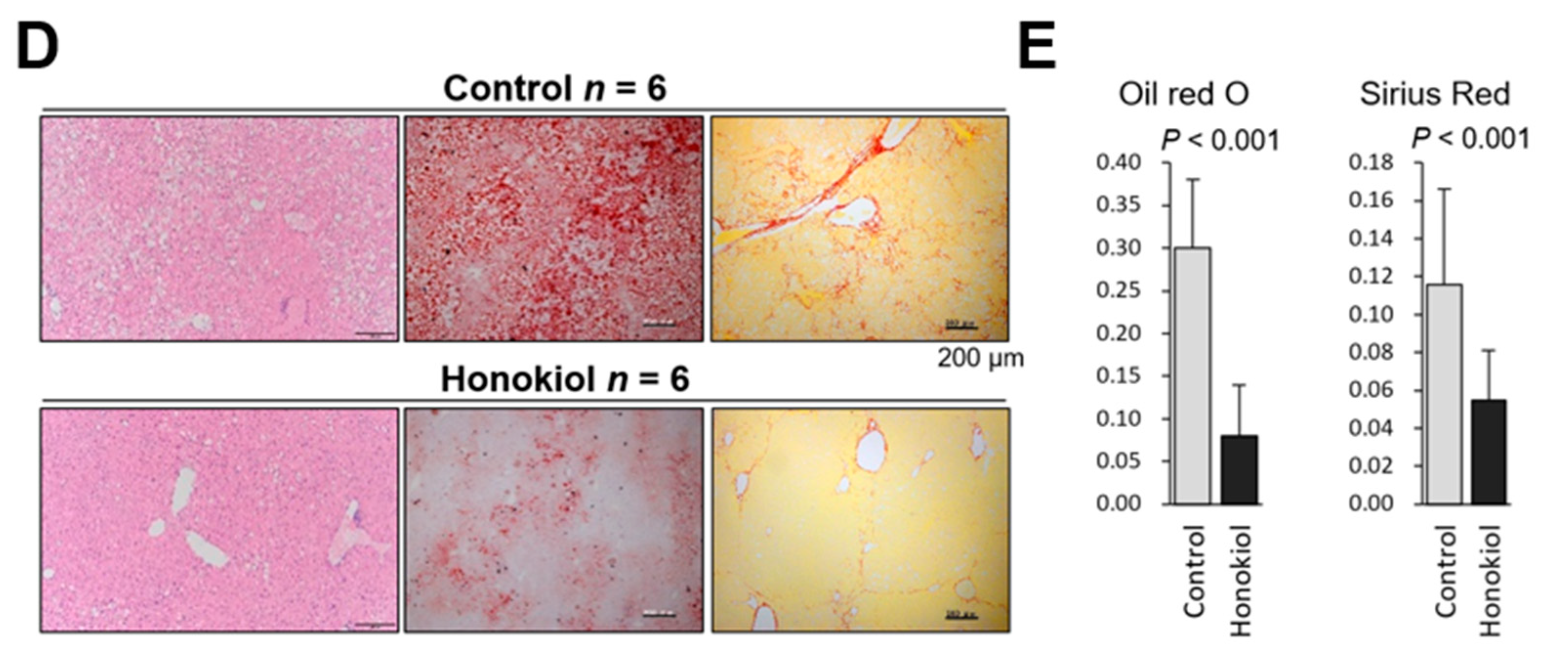 Cancers Free Full Text Honokiol Prevents Non Alcoholic Steatohepatitis Induced Liver Cancer Via Egfr Degradation Through The Glucocorticoid Receptor Mig6 Axis Html