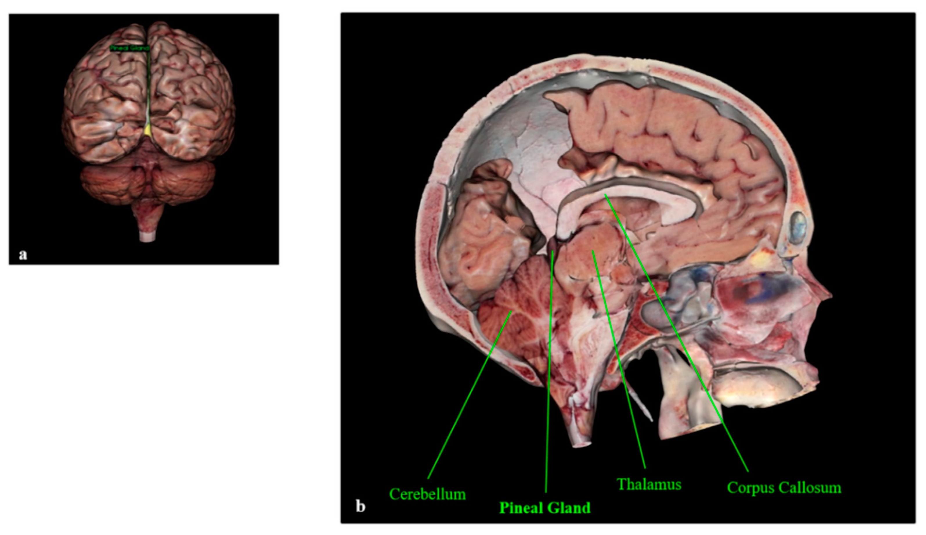 Electrocautery in Brain Surgery - Trial Exhibits Inc.