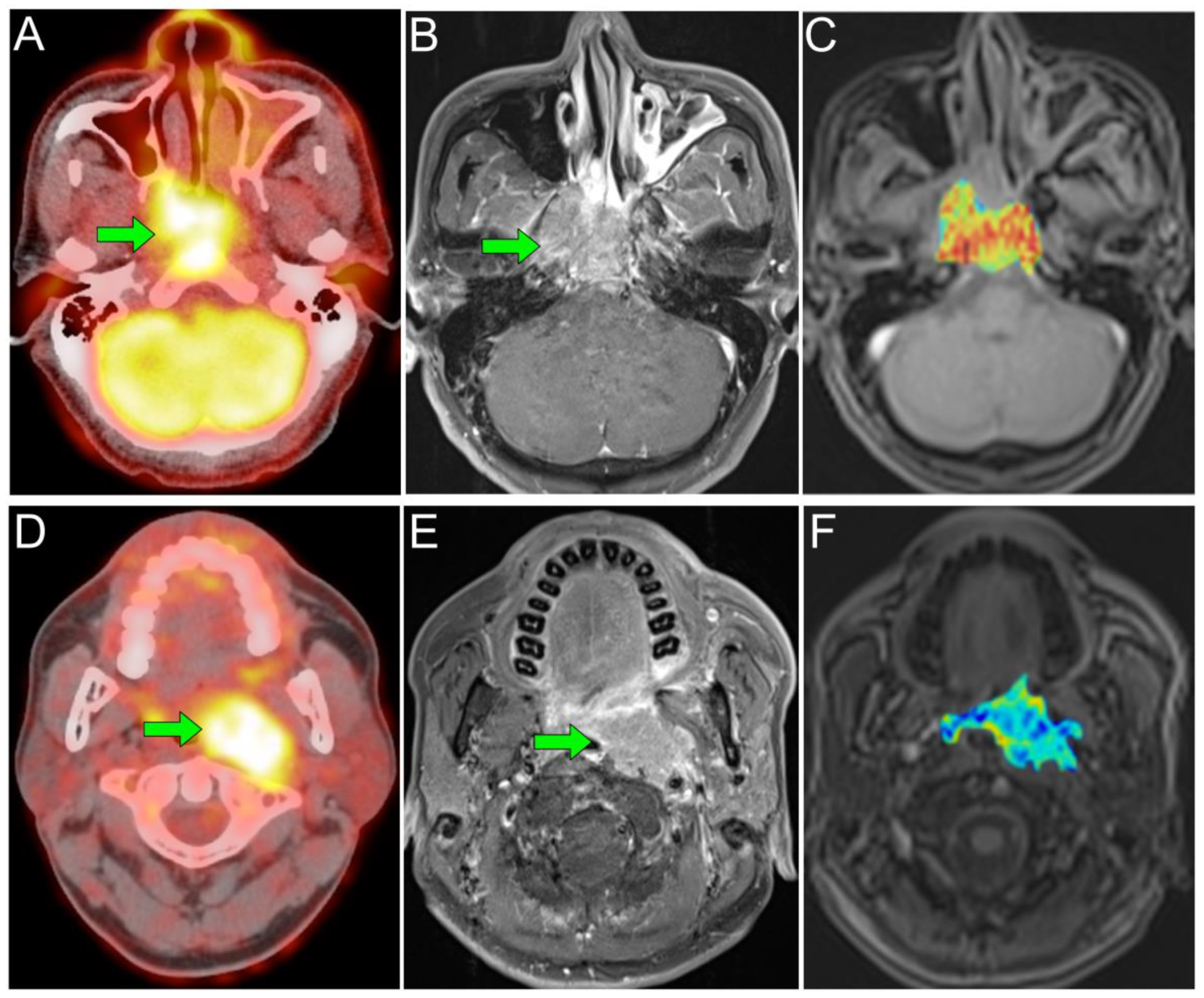 Cancers 13 01550 g003 Cancers 13 01550 g003