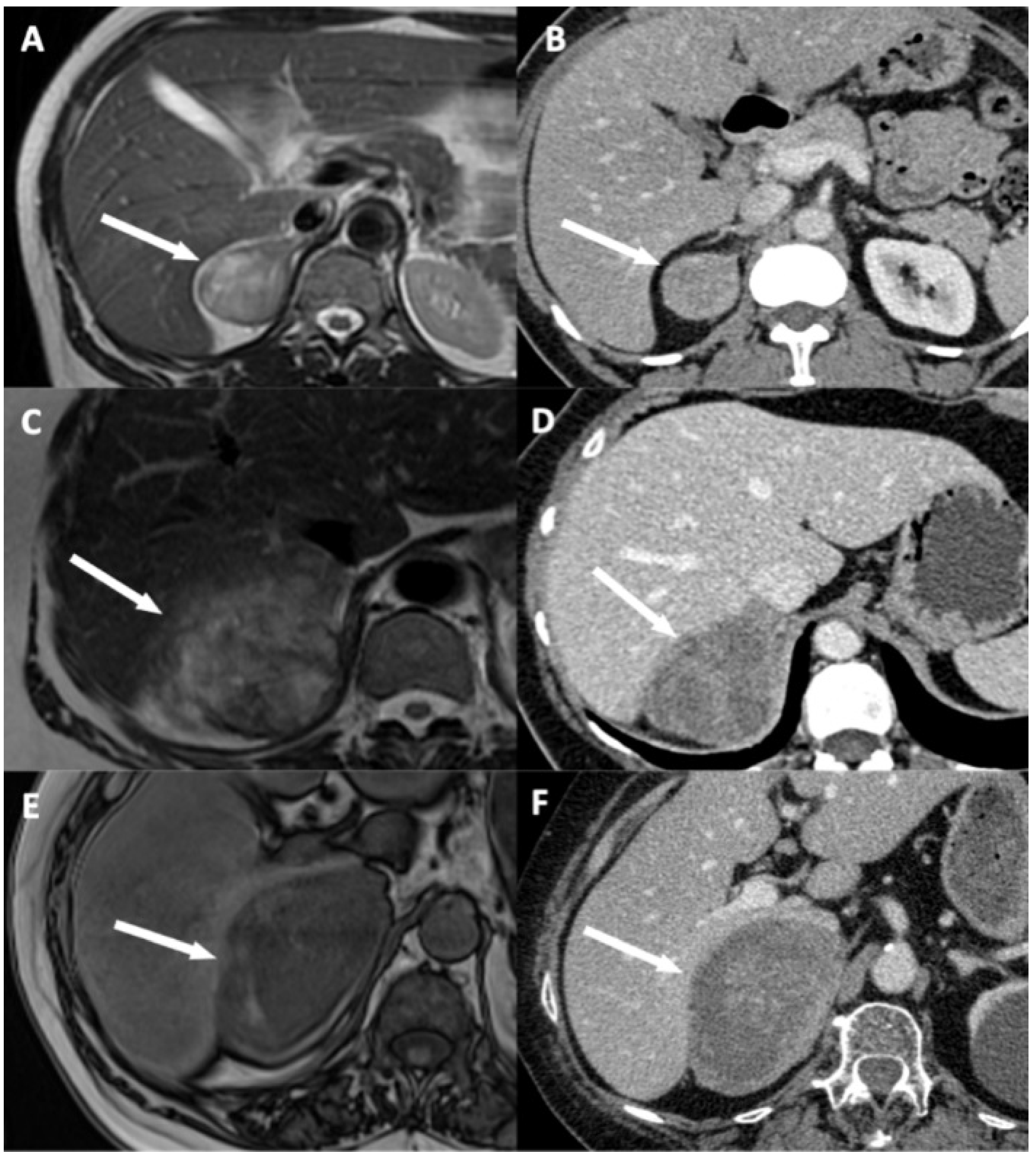 Cancers 13 01603 g003 Cancers 13 01603 g003