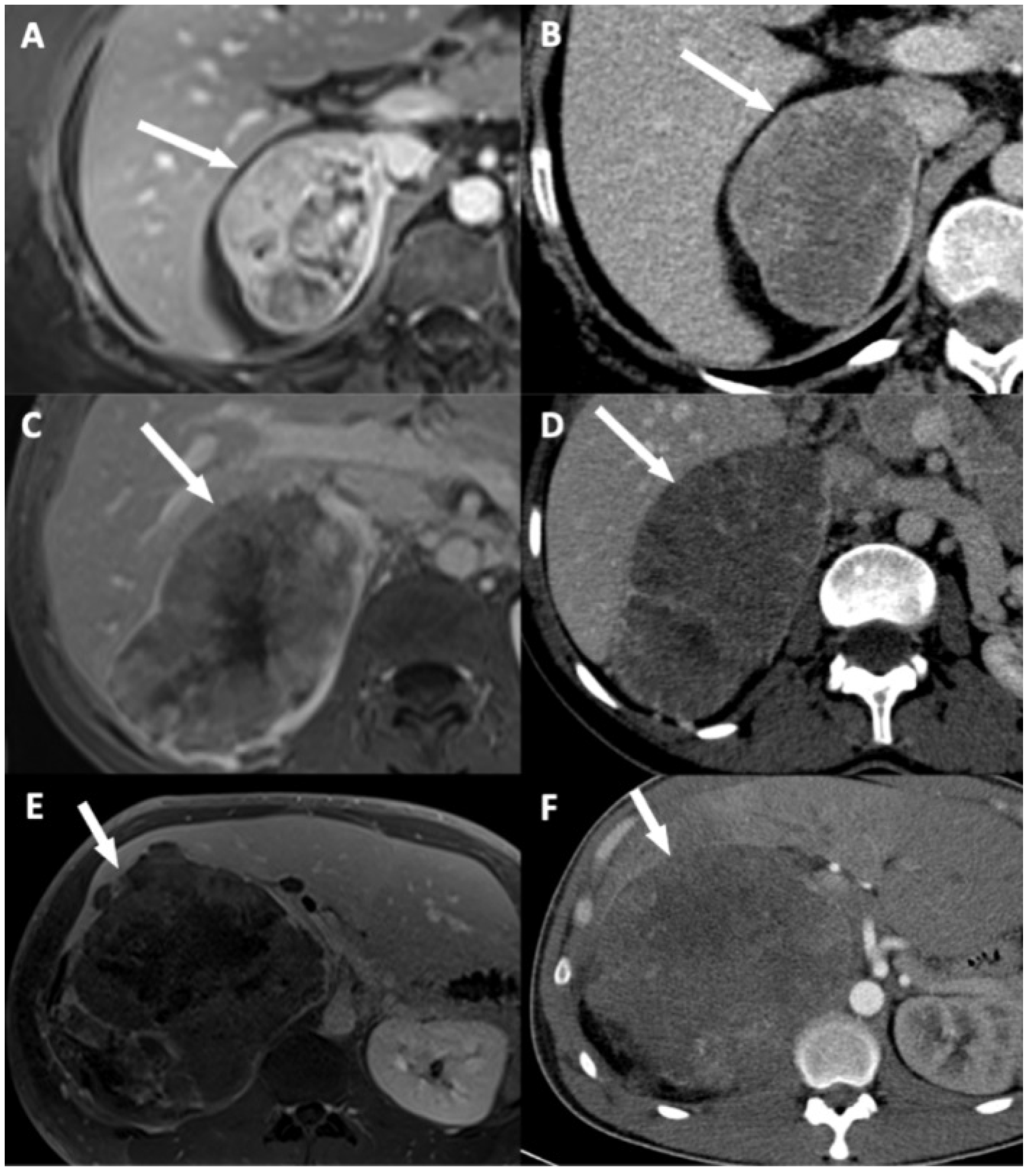 Cancers 13 01603 g004 Cancers 13 01603 g004