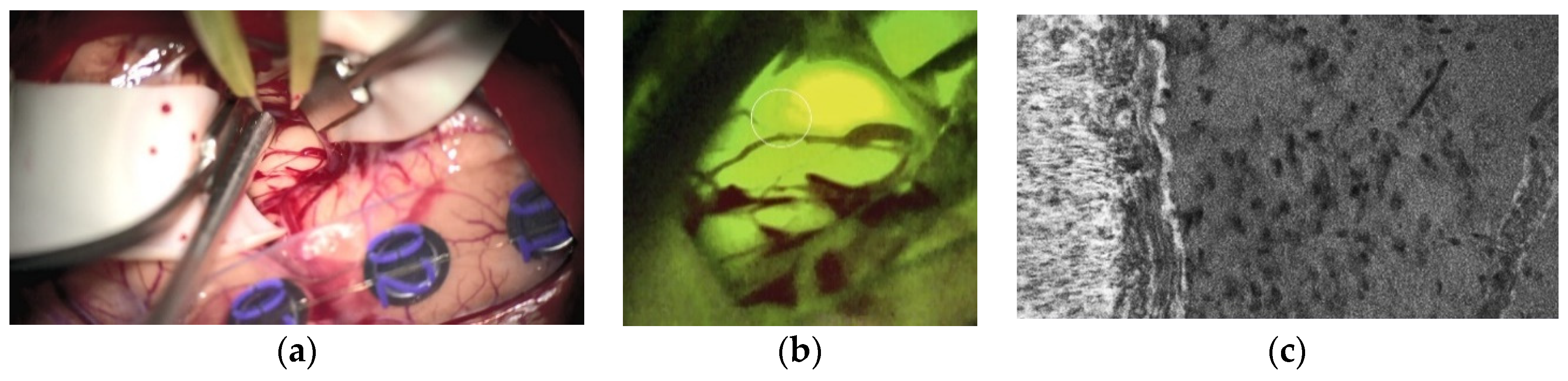 Cancers 13 01616 g003 Cancers 13 01616 g003