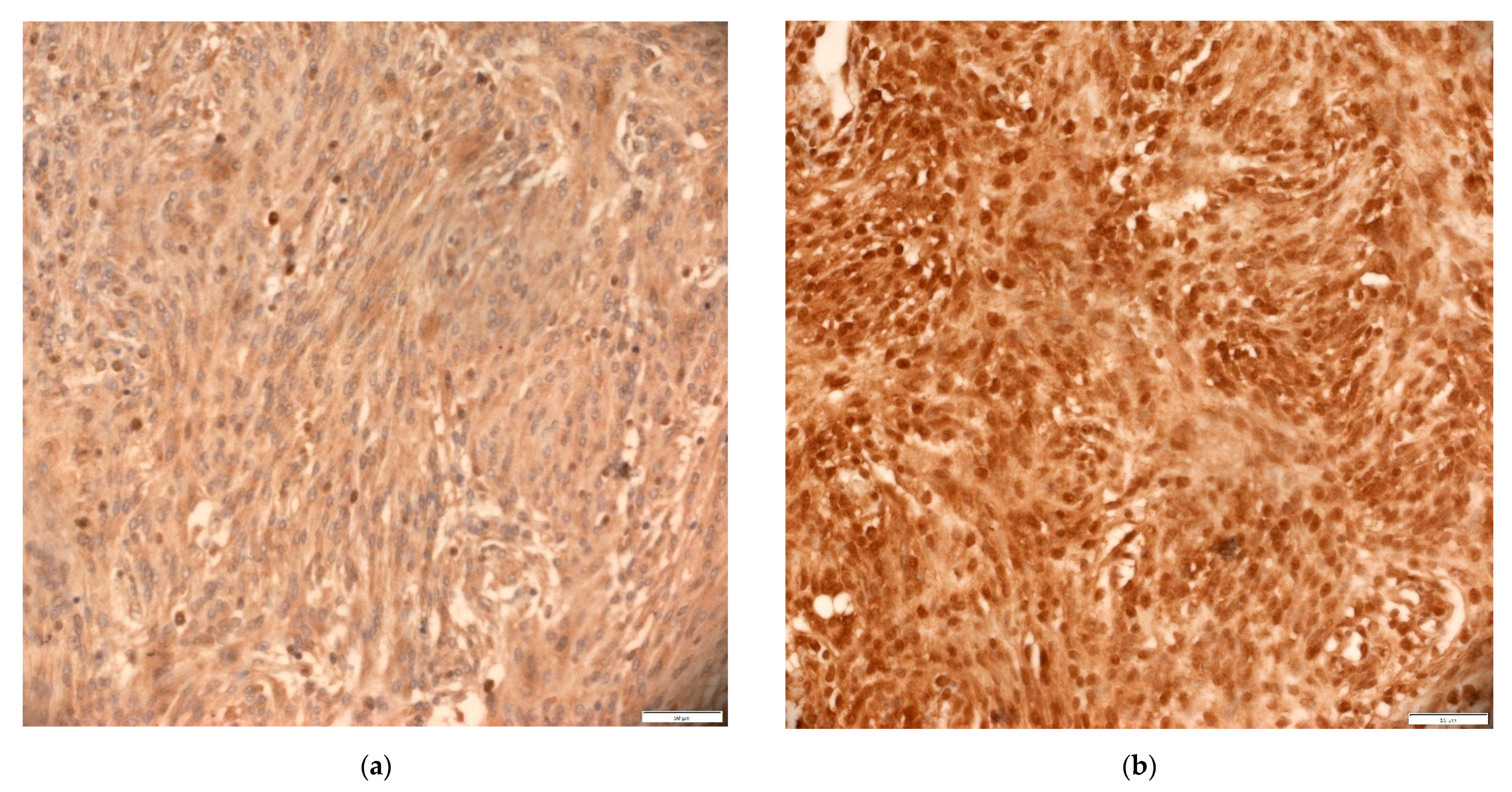 Cancers 13 01633 g004