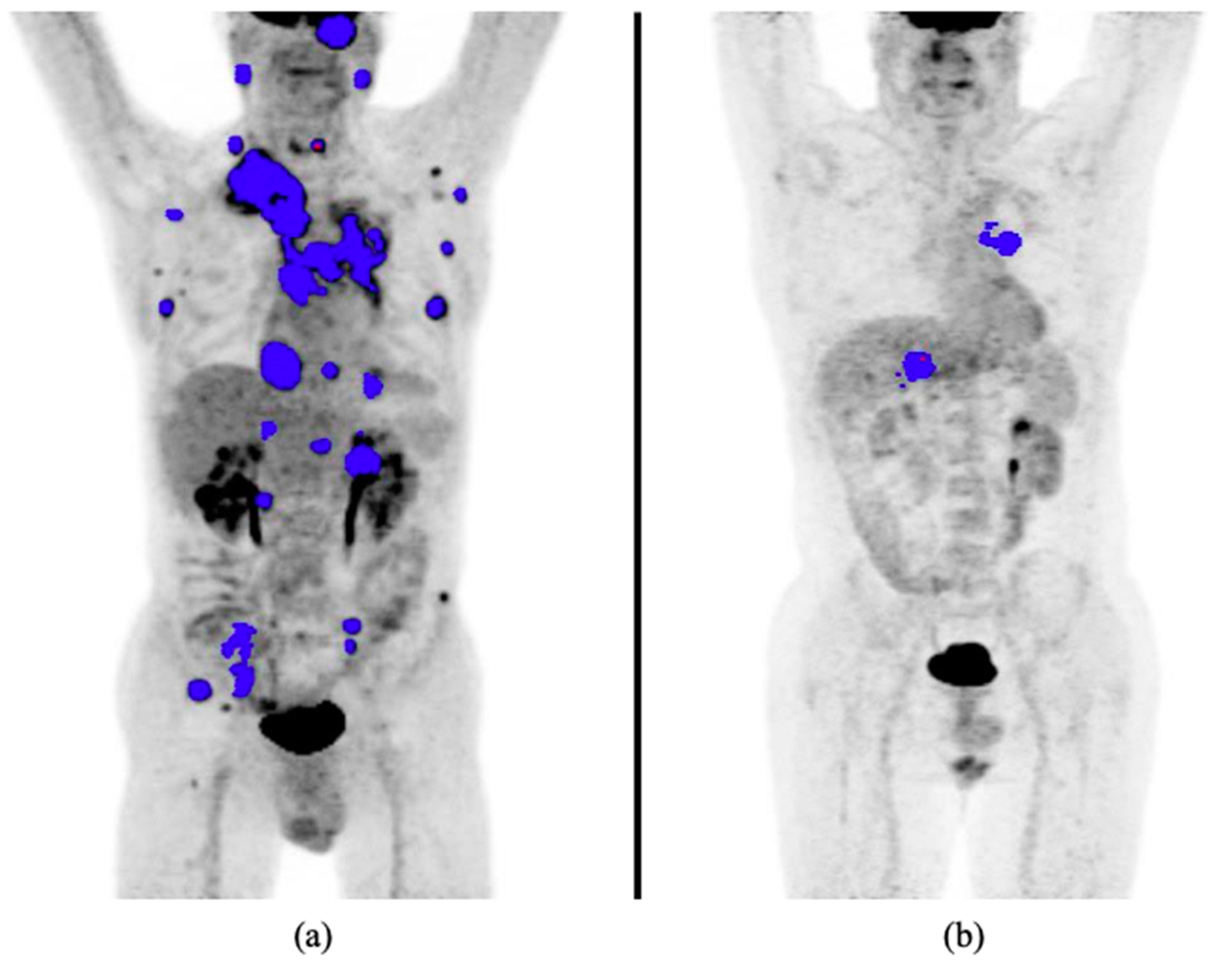 Cancers 13 01634 g001