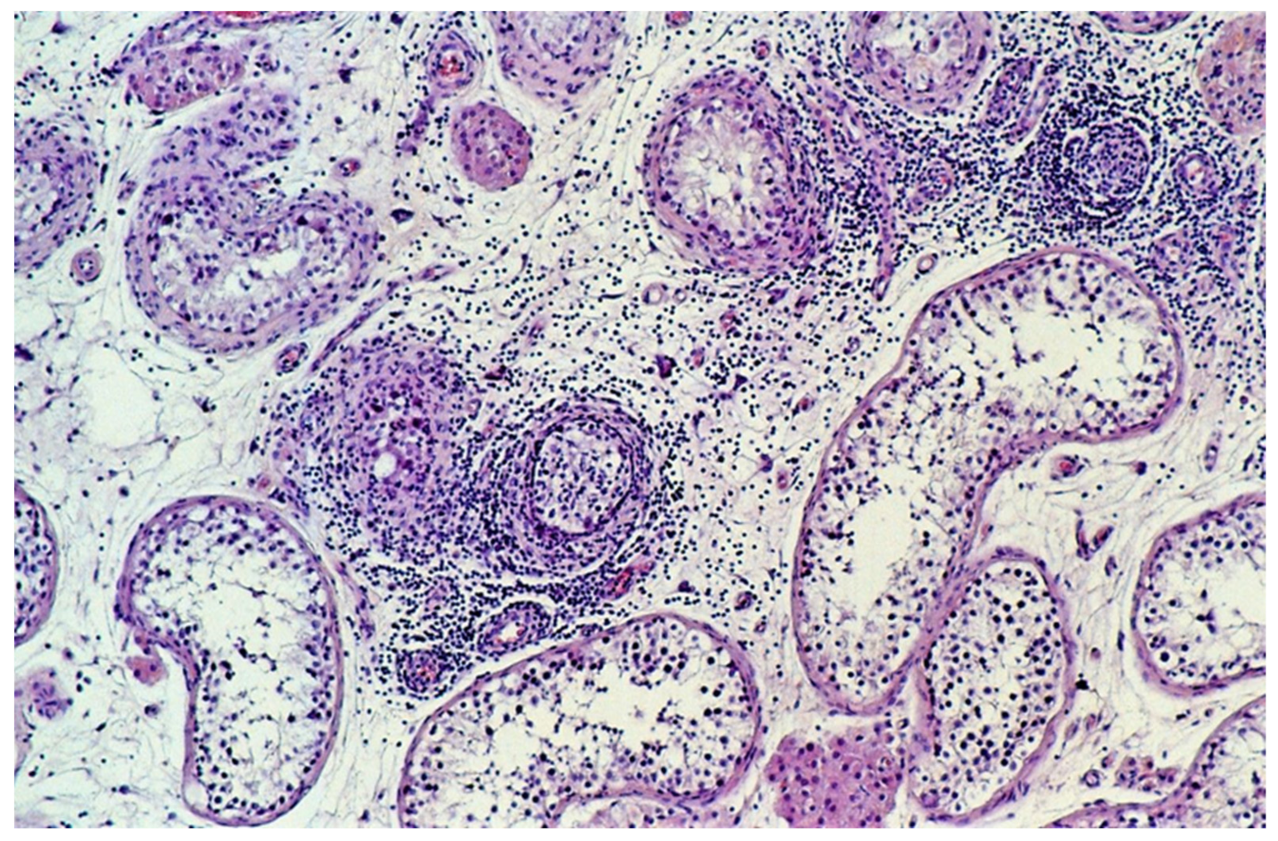 Cancers 13 01652 g001 Cancers 13 01652 g001