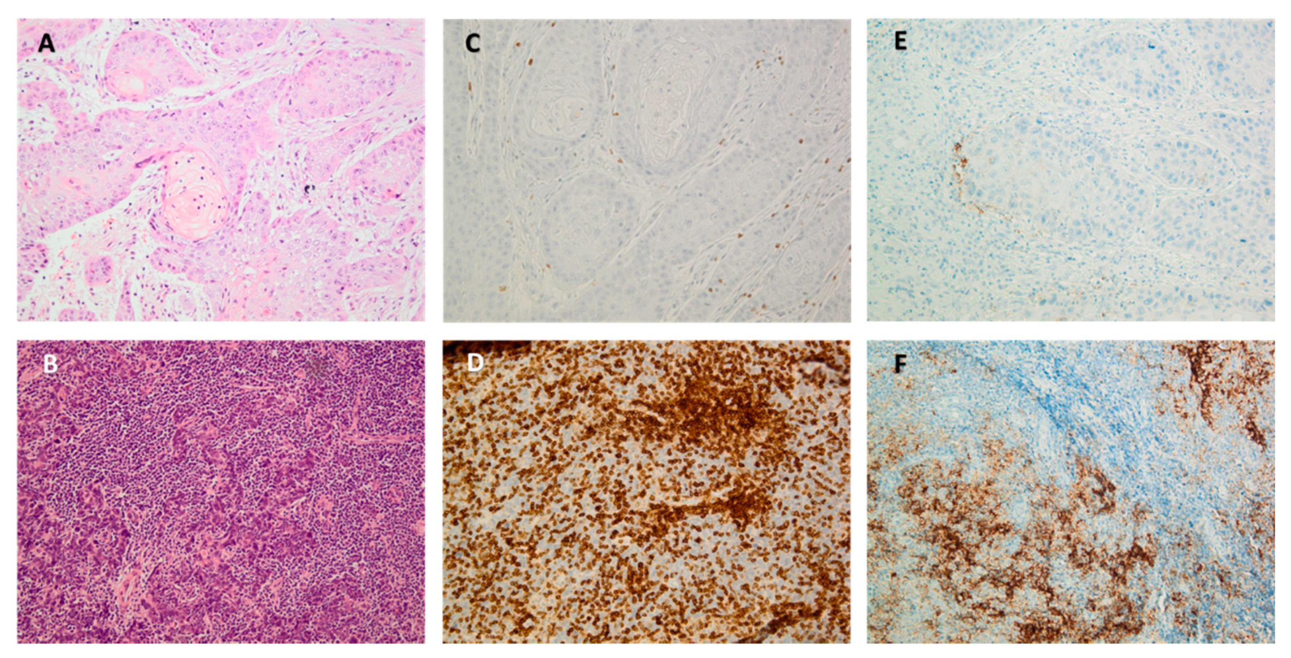 Cancers 13 01714 g002