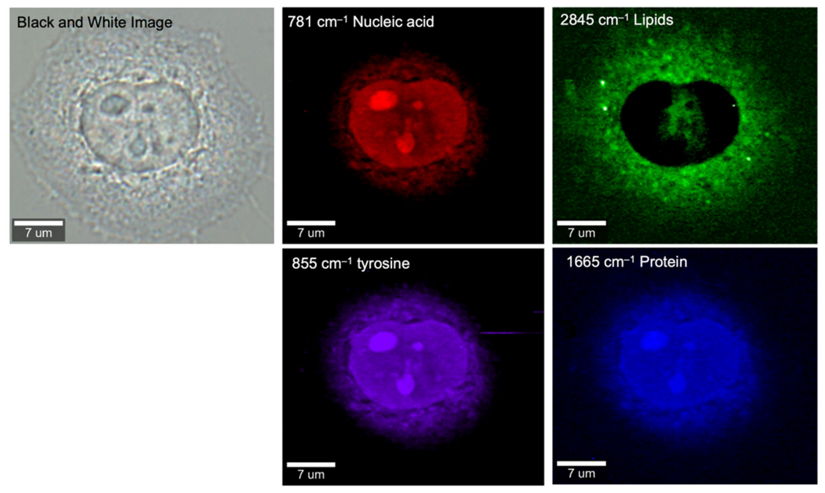 Cancers Free Full Text Unveiling Cancer Metabolism Through Spontaneous And Coherent Raman Spectroscopy And Stable Isotope Probing Html Cancers Free Full Text Unveiling Cancer Metabolism Through Spontaneous And Coherent Raman Spectroscopy And Stable Isotope Probing Html