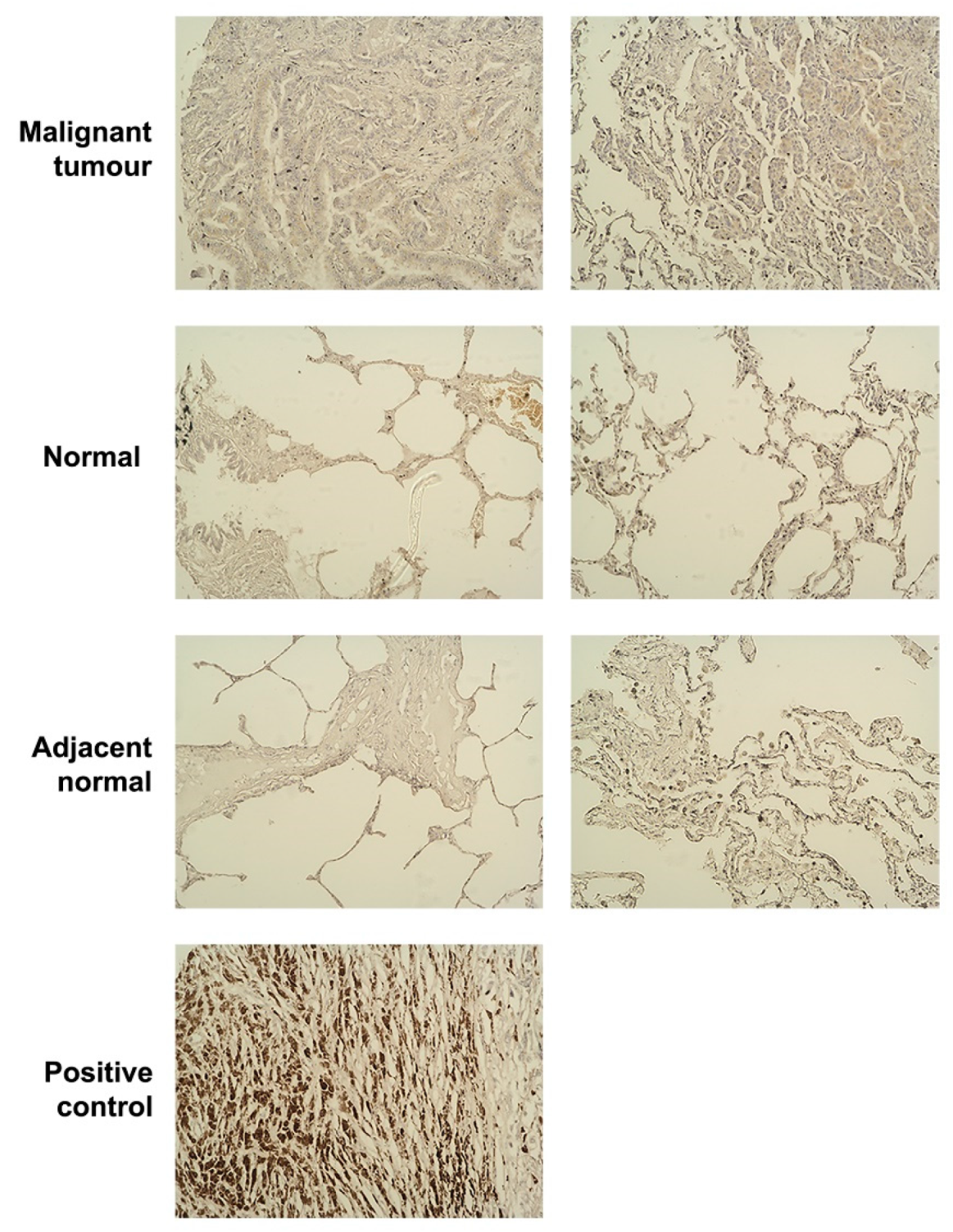 can chemotherapy drugs cause liver damage