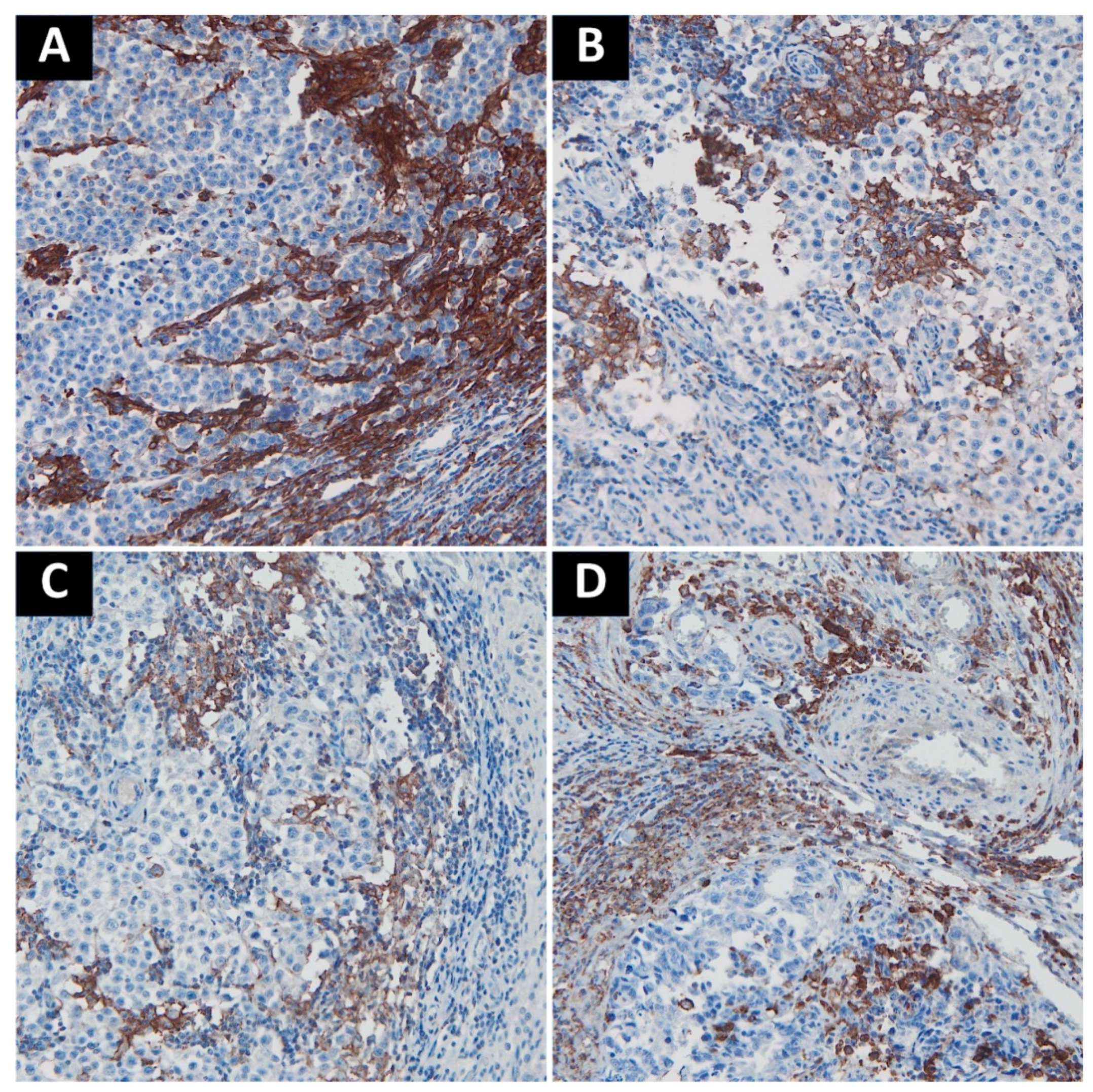 Cancers 13 01750 g002 Cancers 13 01750 g002