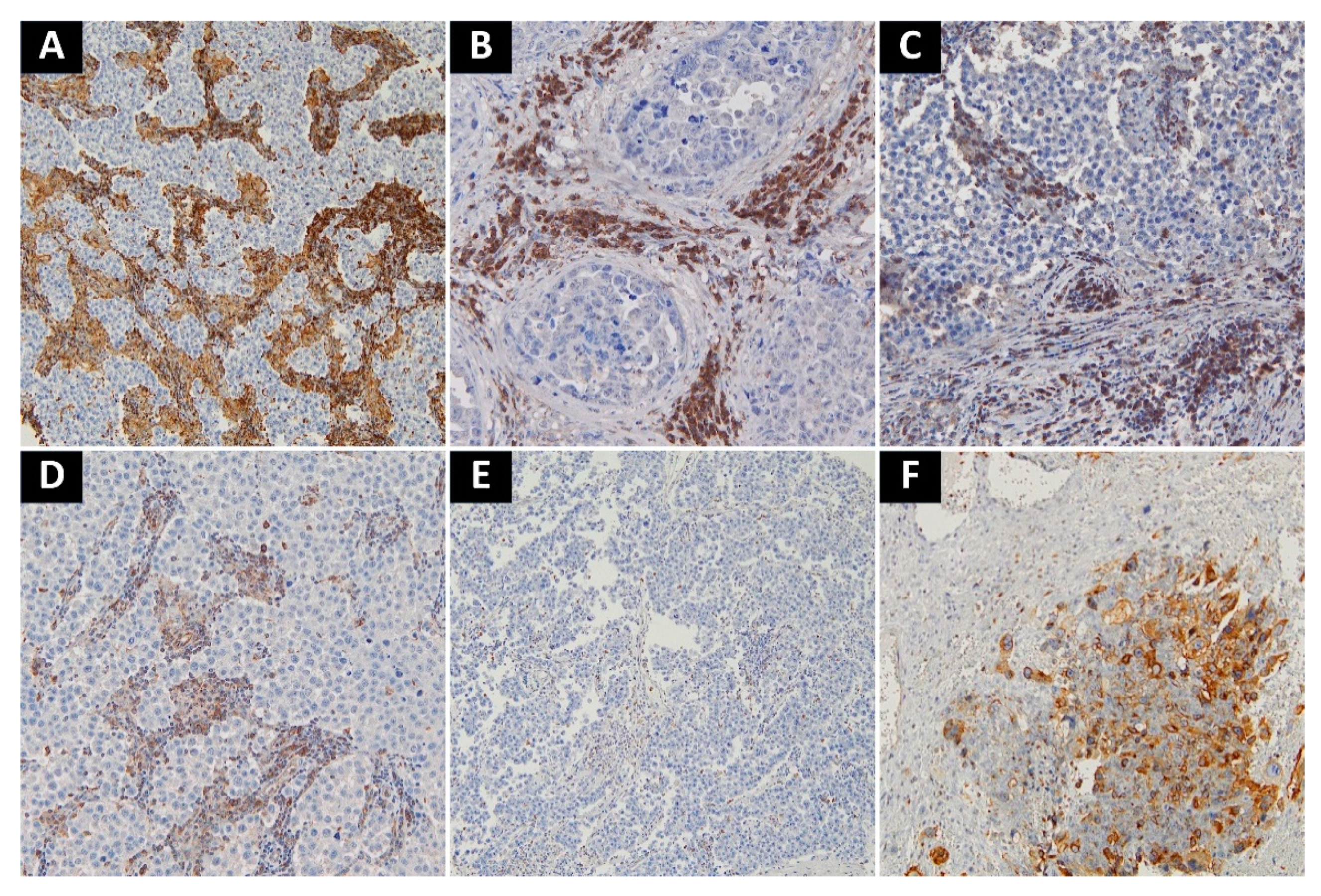 Cancers 13 01750 g003 Cancers 13 01750 g003